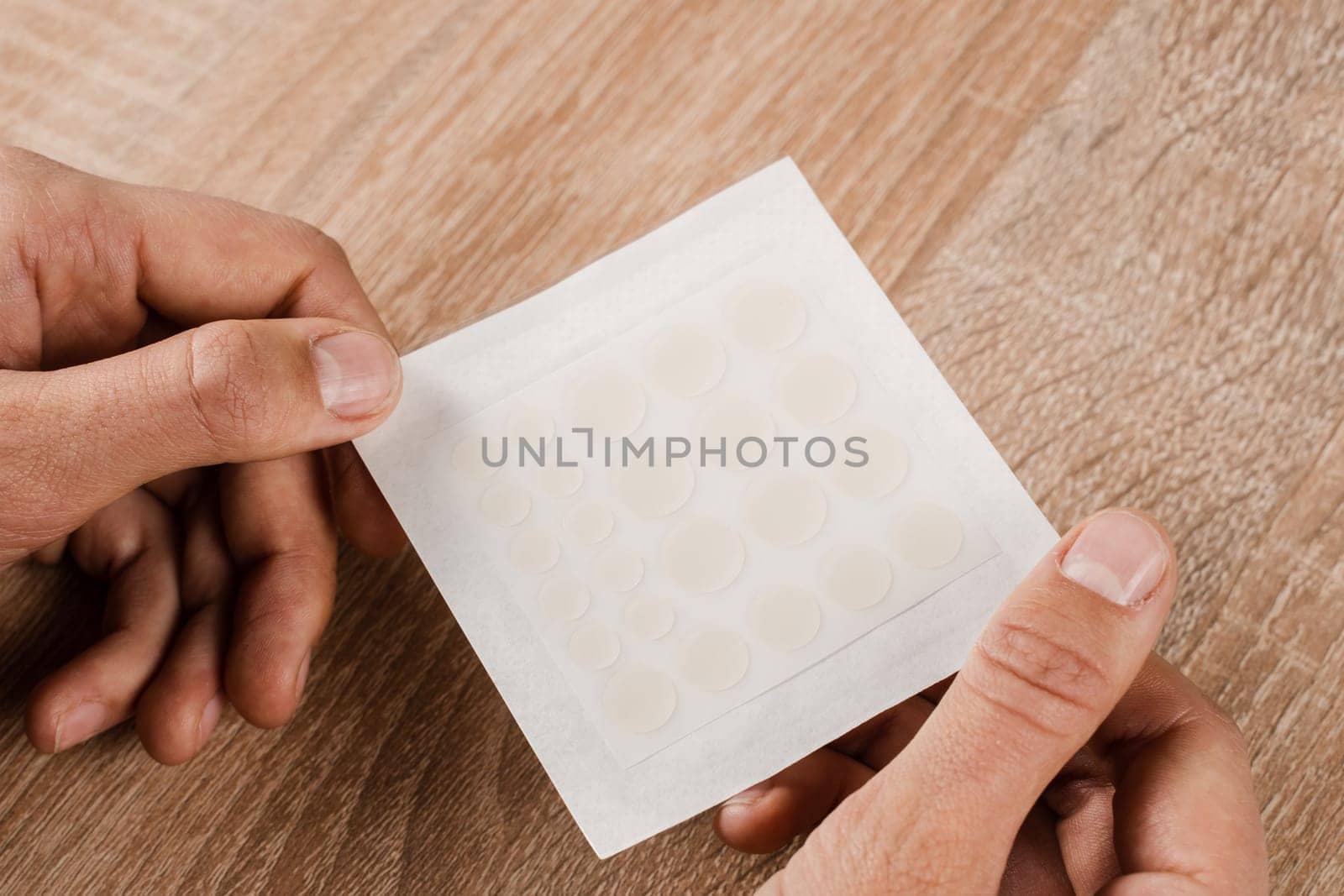Set of round patches for acne in hands on wooden background. Close-up acne patch for facial rejuvenation. Facial cleansing cosmetology. by Rabizo
