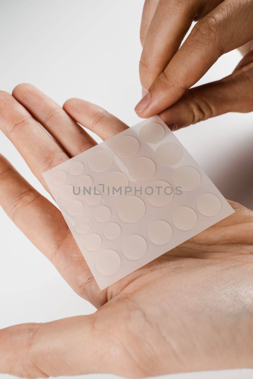 Acne patches for treatment of pimple and rosacea close-up. Facial rejuvenation cleansing cosmetology. Set of round patches for acne in hands on white background. by Rabizo