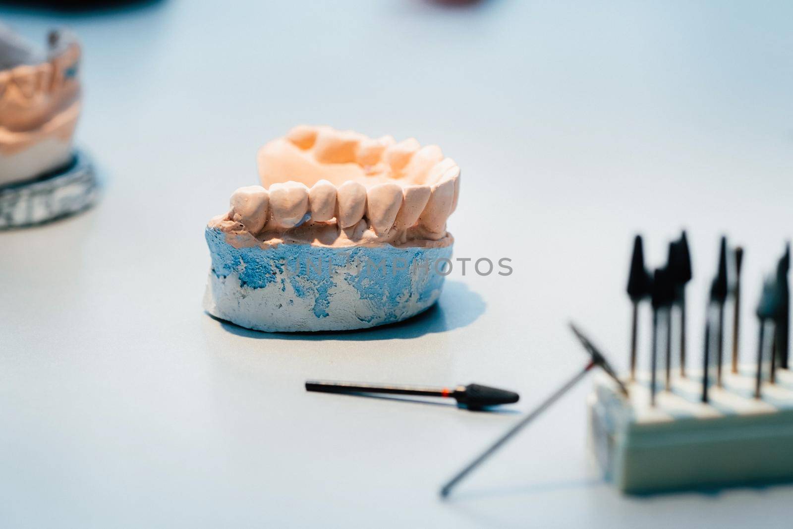 Model of teeth made of plaster of the jaw for dental technicians.