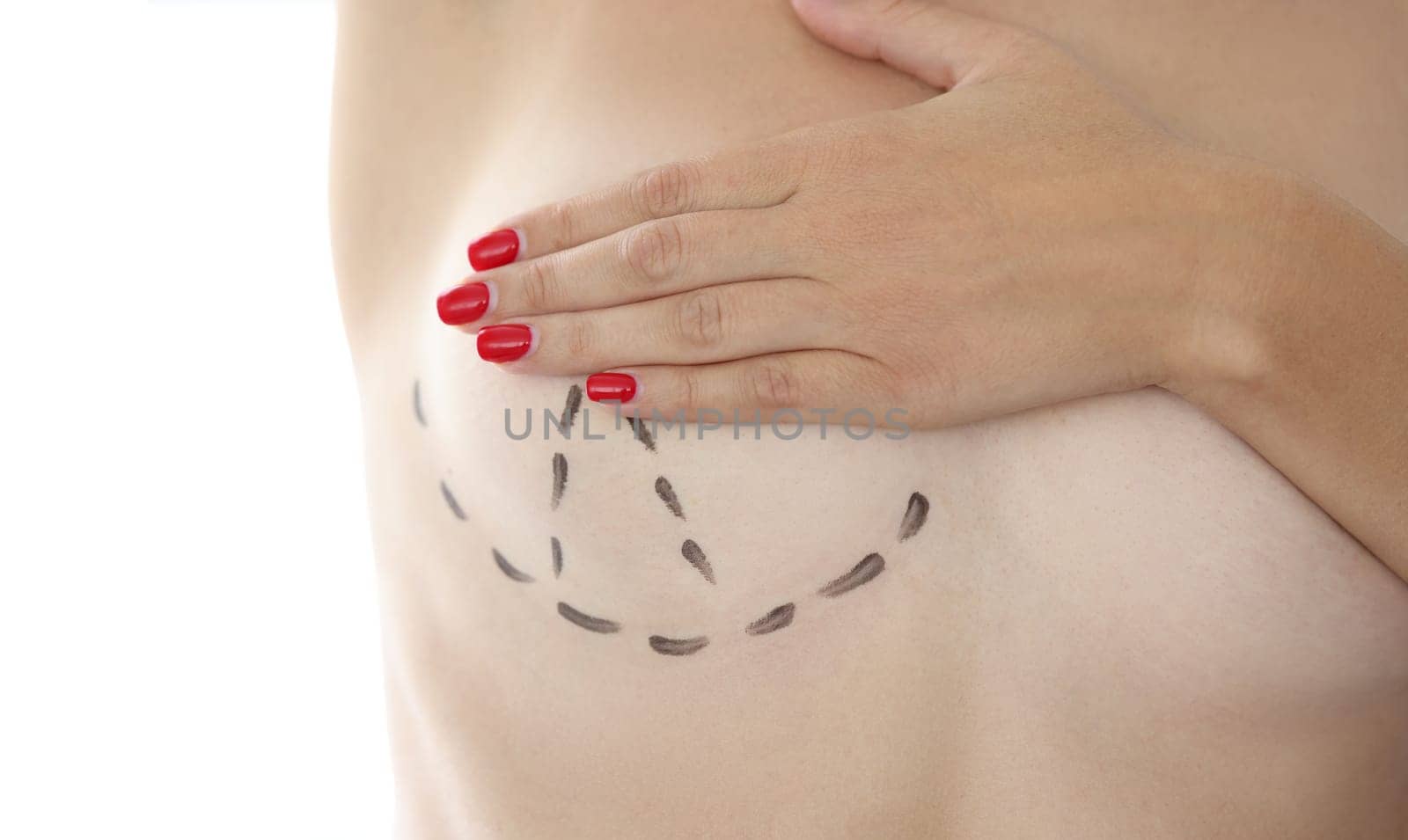 Correction lift breast augmentation and plastic surgery. Preparation for mammoplasty concept