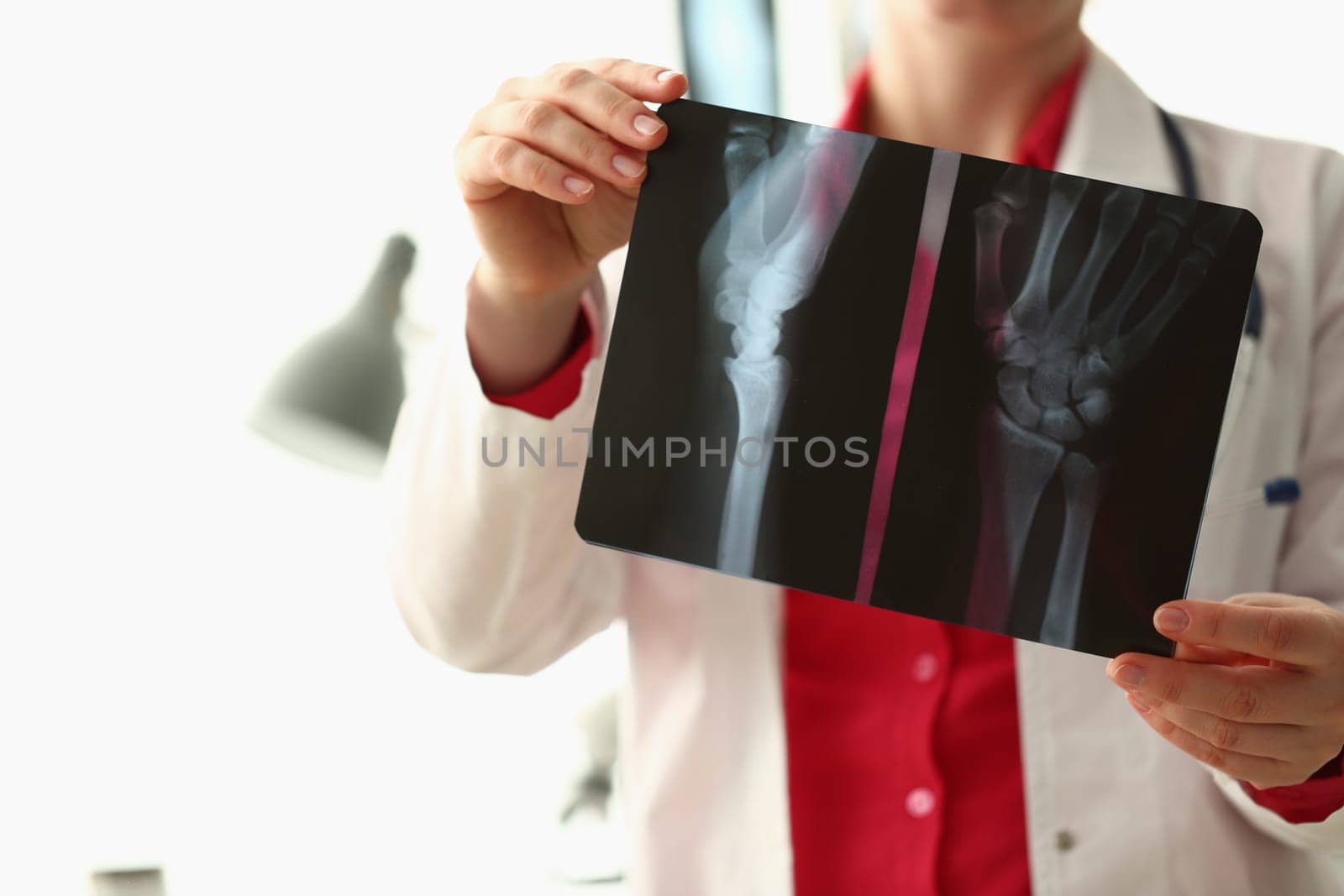 Orthopedist examines x-ray of patient hand in clinic by kuprevich