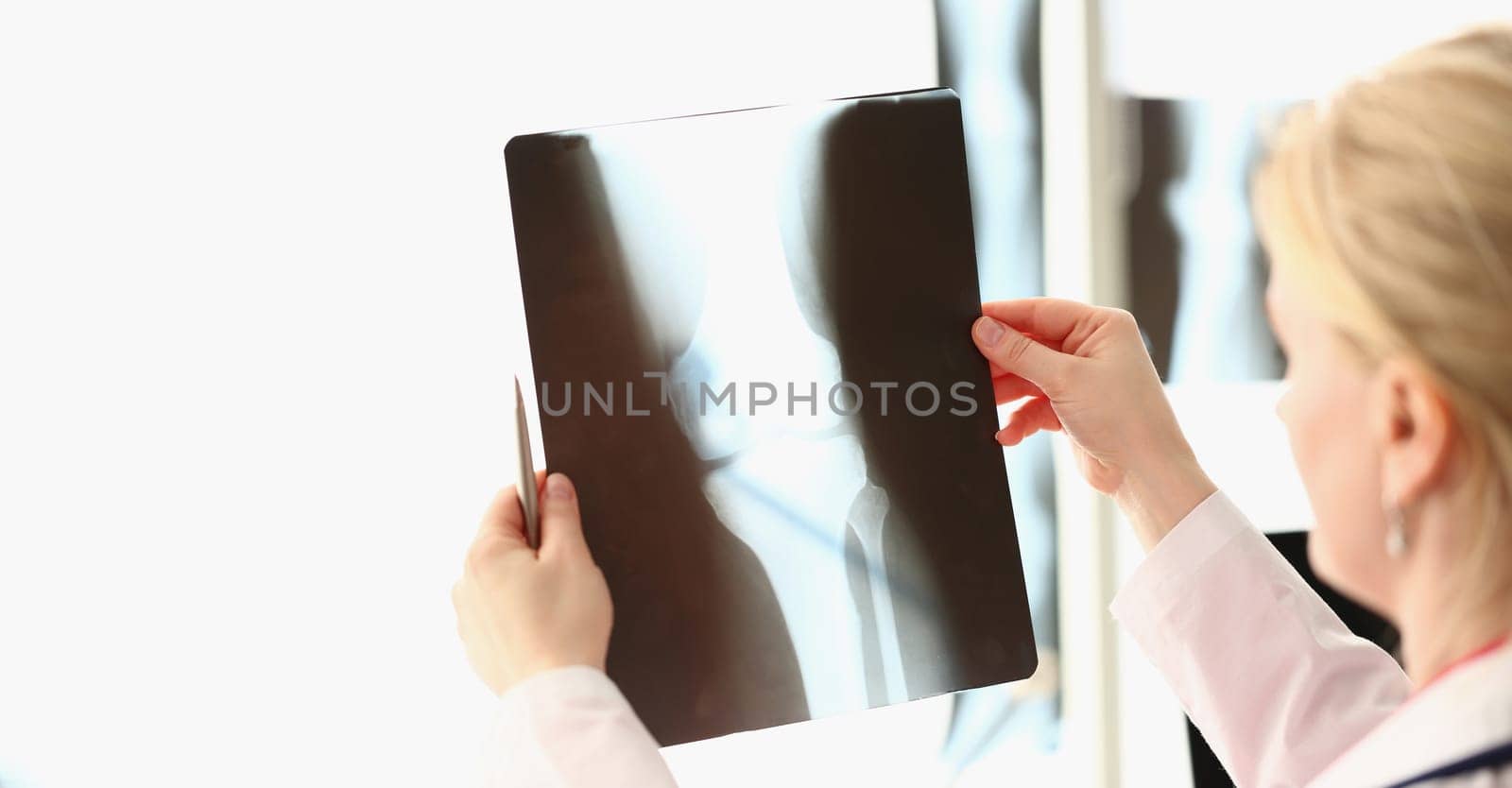 Doctor examines an x-ray of patient knee in clinic. Arthritis knee joint concept