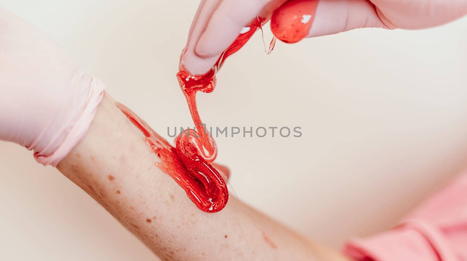 Shugaring master applying thick sugar paste on lady's hand, removing unwanted hair. Hair removal with a special sugar paste has many advantages over wax depilation.