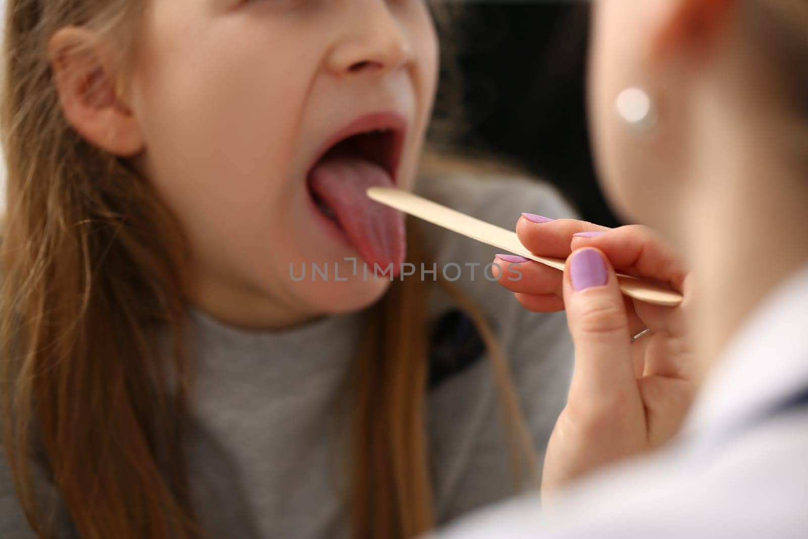 Doctor conducts medical examination of sick red throat of little girl. Angina in children concept