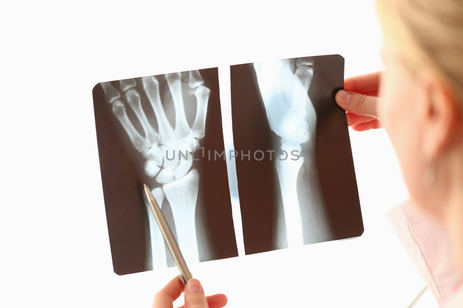 Doctor looks at x-ray of hands closeup by kuprevich