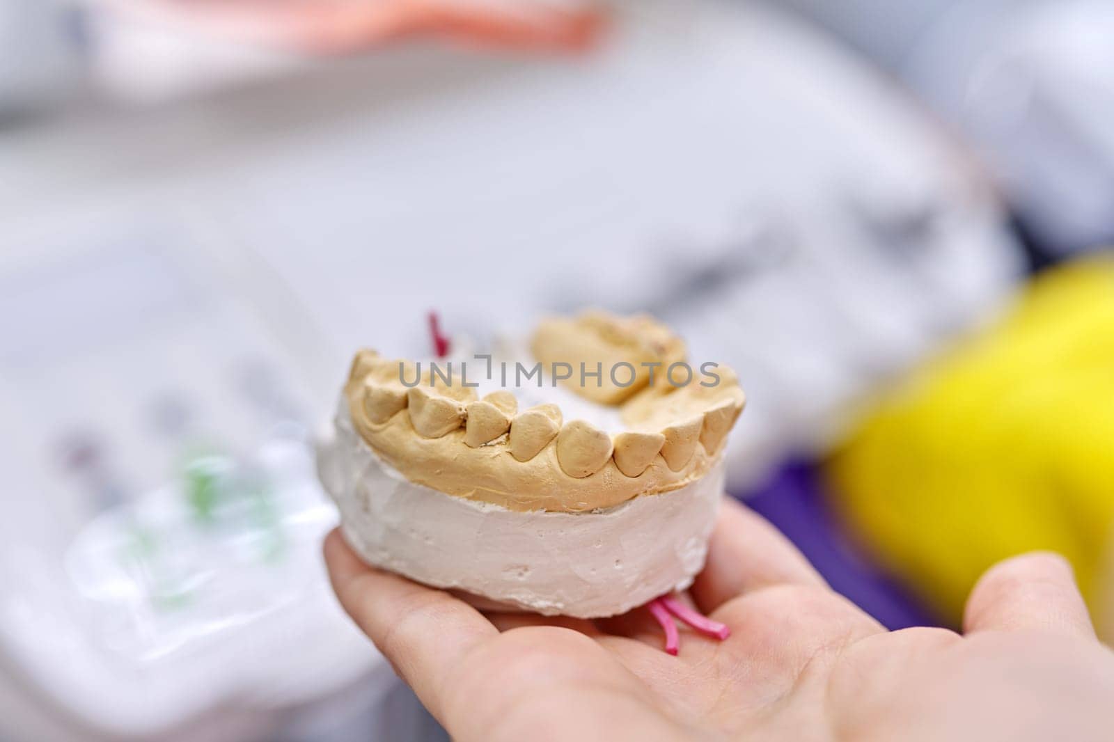 Gypsum model of teeth of jaw, dentist office background, orthopedics prosthetics dentistry concept