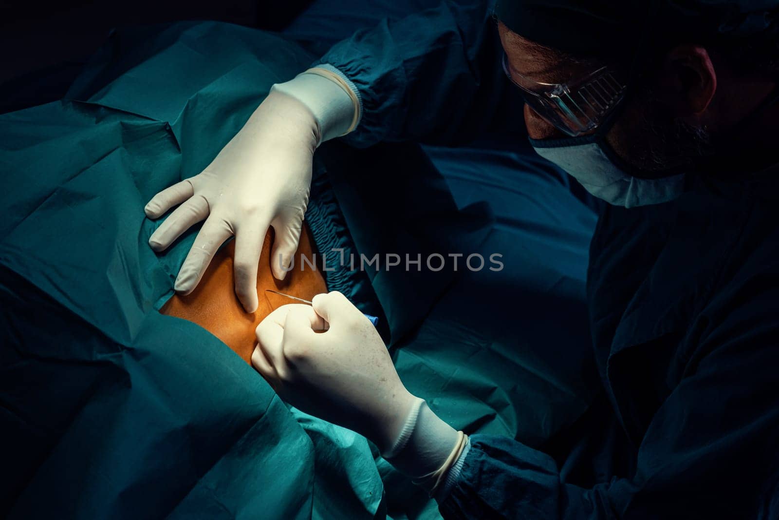 Surgeon inject anesthesia with syringe into the patient before perform surgery in sterile operation room with modern surgical equipments. Medical surgery perform by professional and confident surgeon.