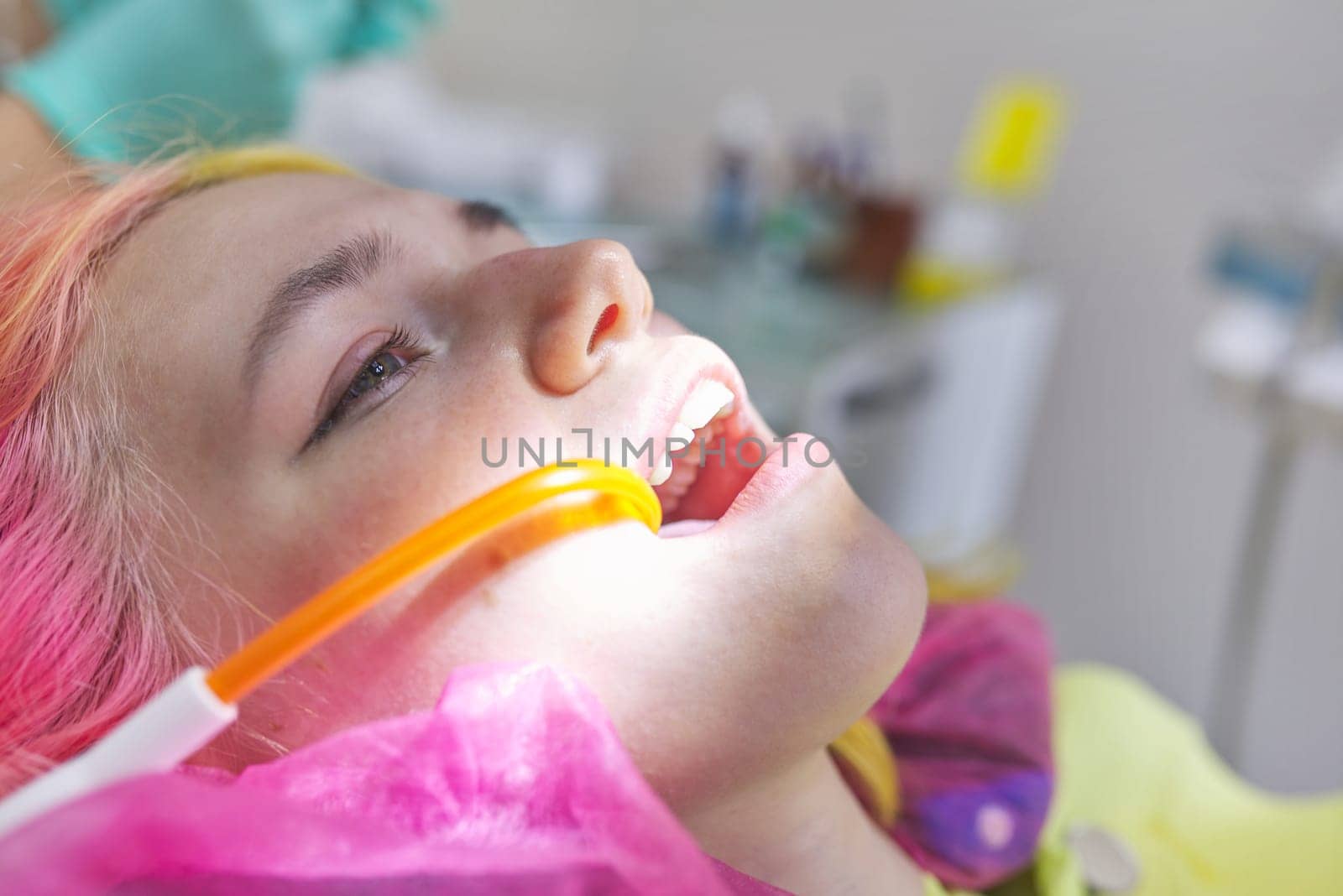 Patient's head with open mouth and saliva tube in mouth by VH-studio