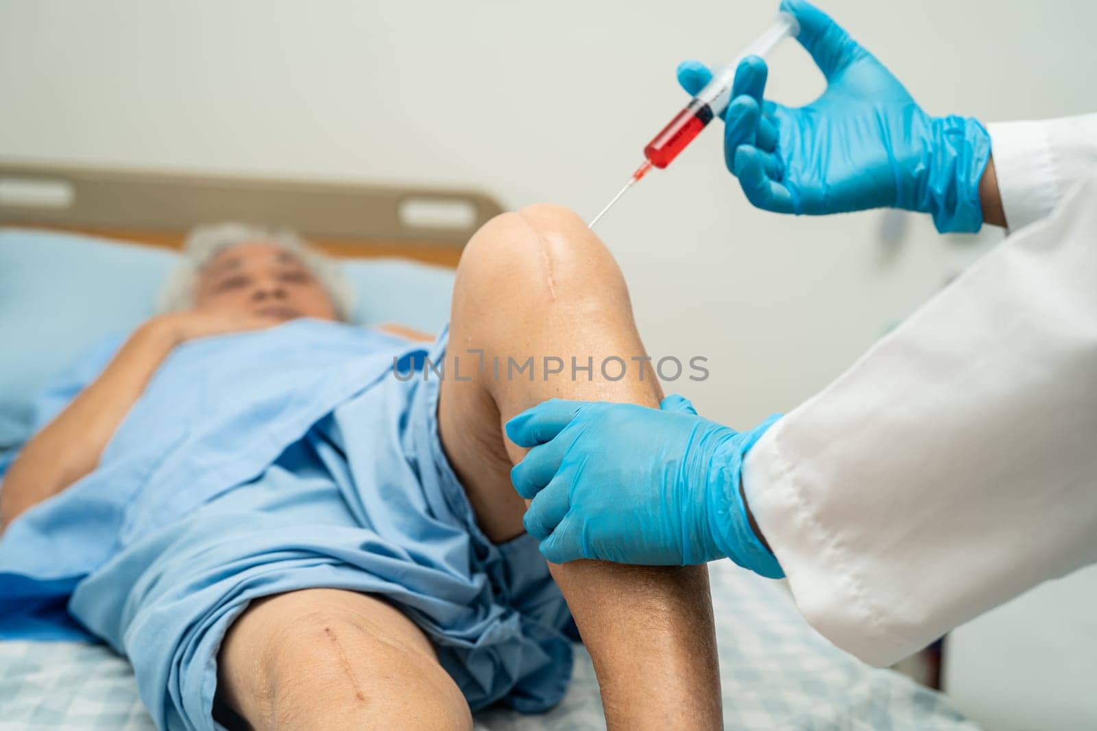 Asian doctor inject Hyaluronic acid platelet rich plasma into the knee of senior woman to walk without pain.