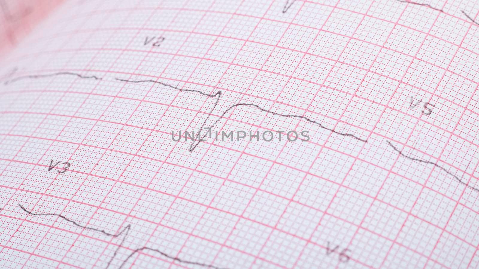 Cardiogram lines on pink paper close up, macro photo