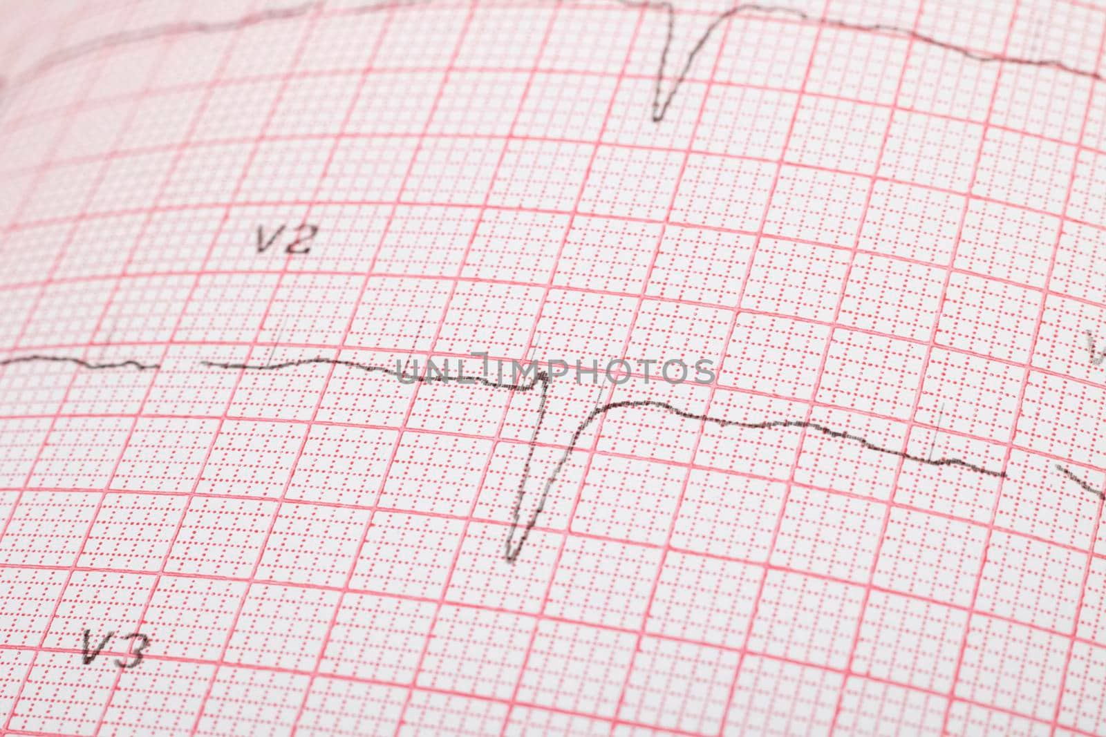 Cardiogram lines on pink paper close up, macro photo