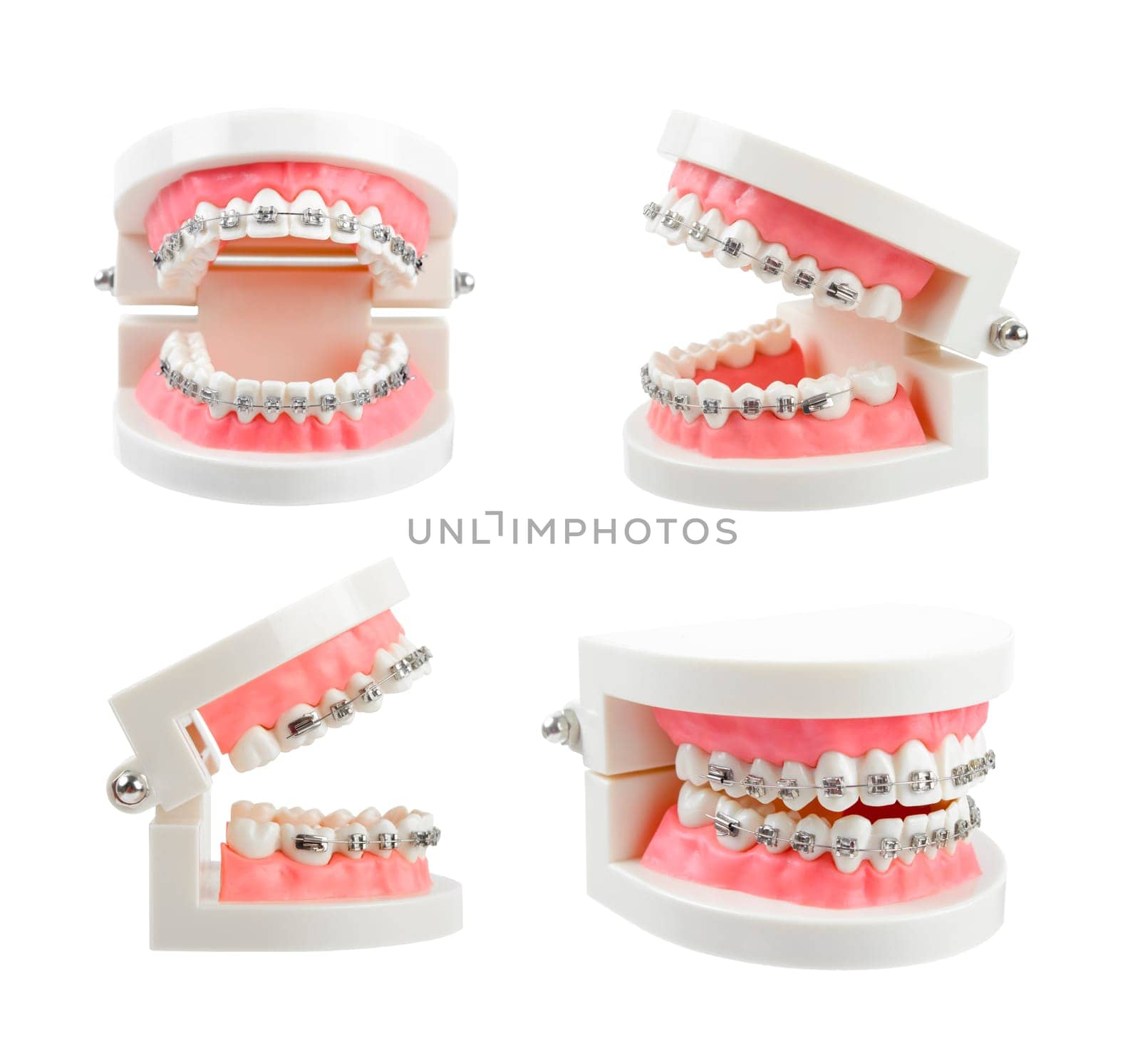 Set teeth model with metal wire dental braces or dental instruments isolated on white background, Save clipping path.