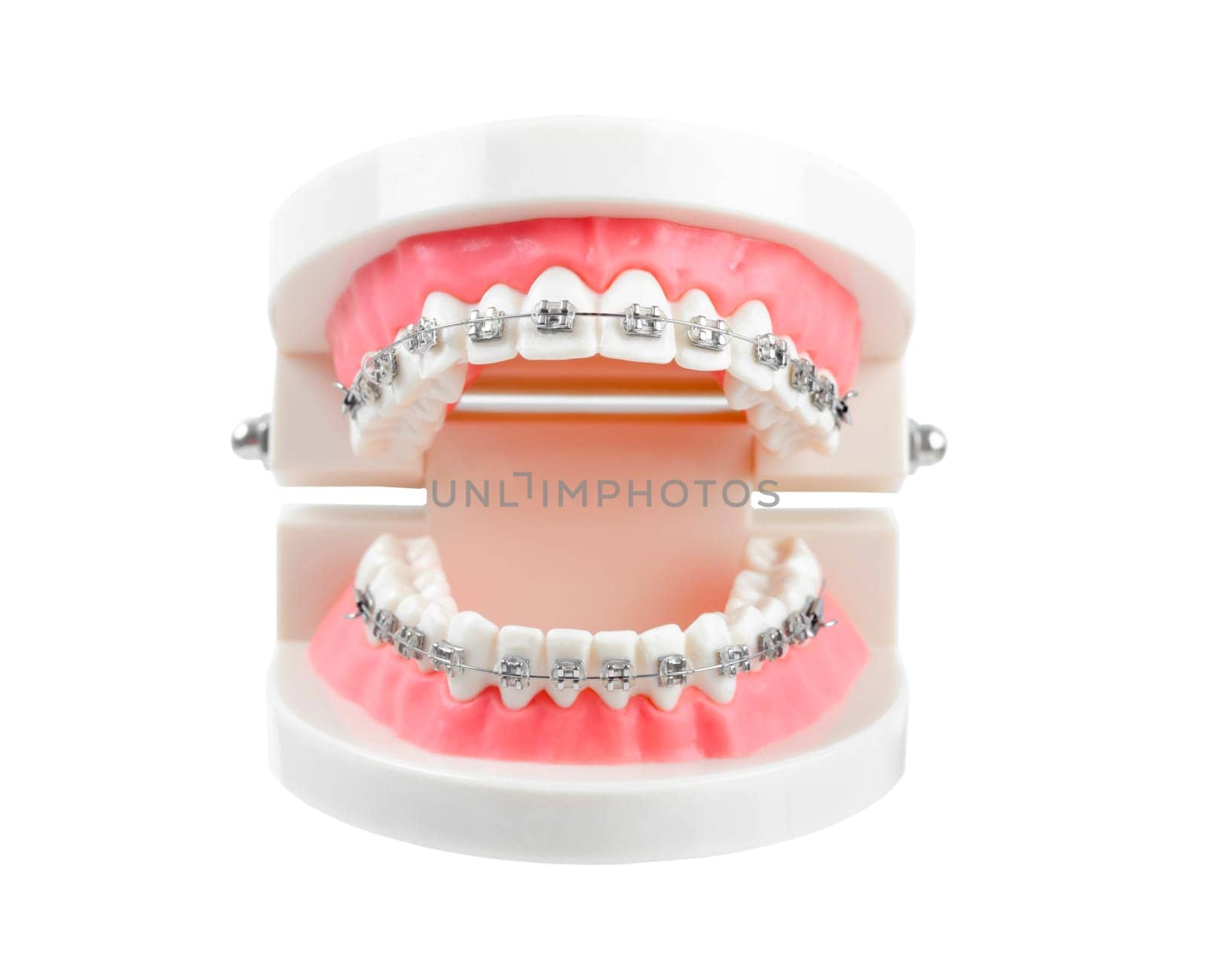 The Teeth model with metal wire dental braces or dental instruments isolated on white background, Save clipping path. by Gamjai