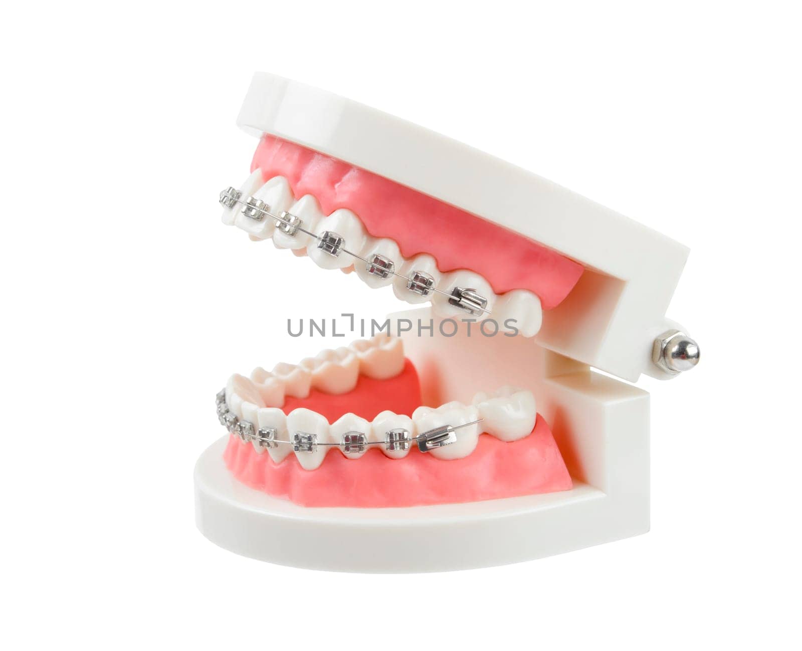The Teeth model with metal wire dental braces or dental instruments isolated on white background, Save clipping path. by Gamjai