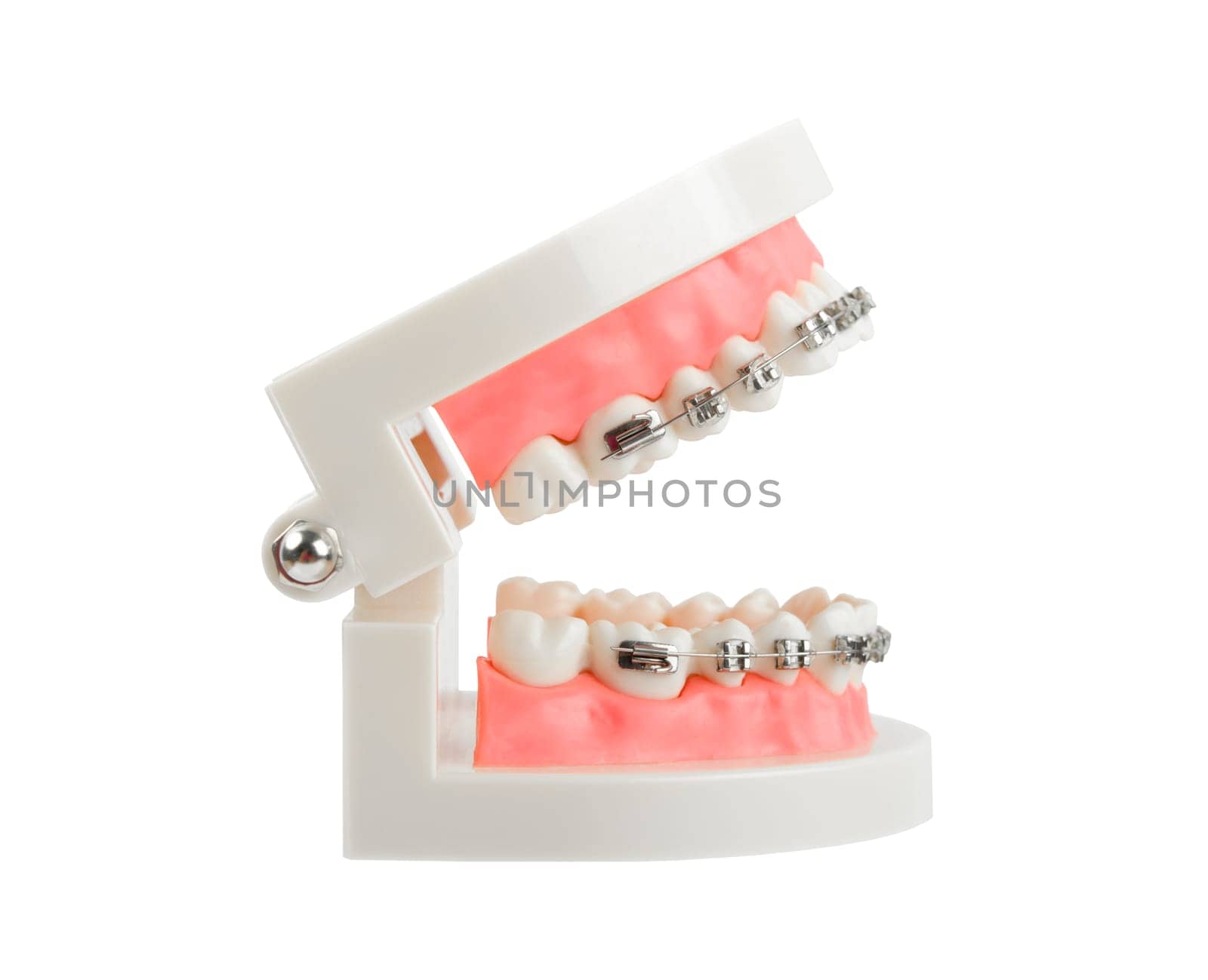 Teeth model with metal wire dental braces or dental instruments isolated on white background, Save clipping path.