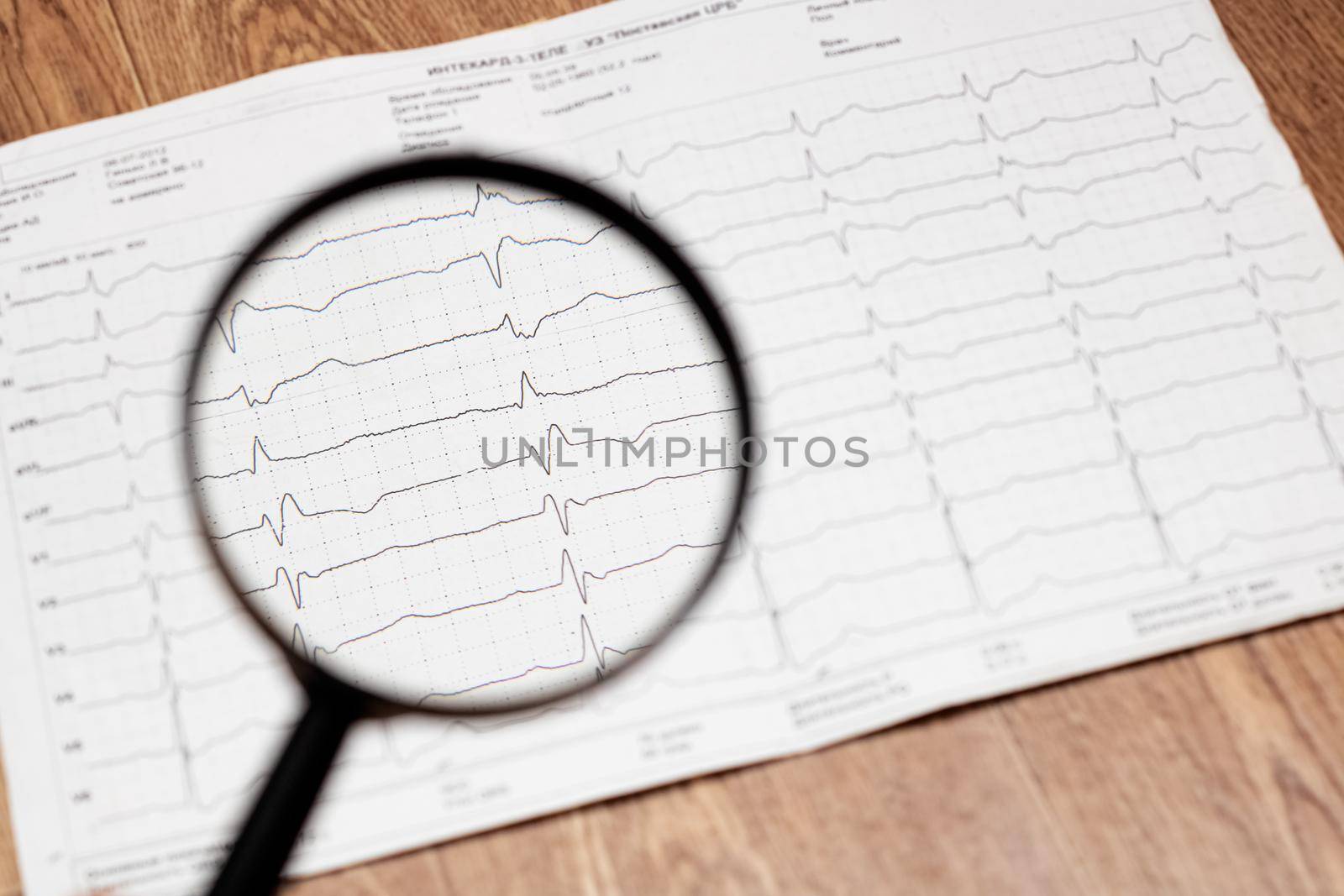 Cardiorgram line and magnifier lens close up with blurred background