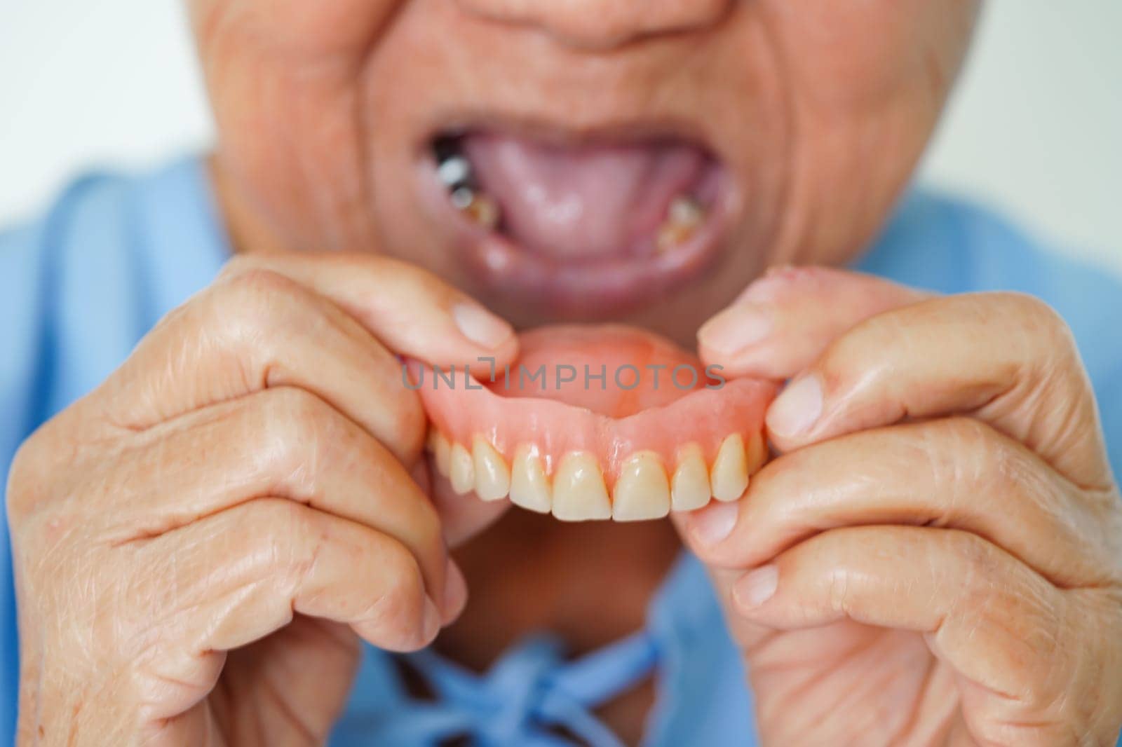 Asian senior woman patient wearing teeth denture into her mouth for chew food. by sweettomato