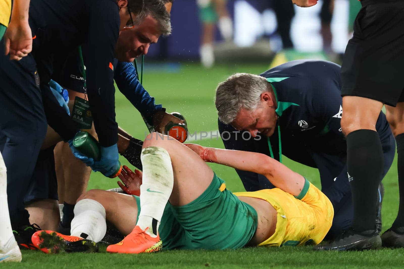 MELBOURNE, AUSTRALIA - MARCH 28: Cameron Devlin of Australia has a cut to the head during an international friendly match between the Australia Socceroos and Ecuador at Marvel Stadium on March 28, 2023 in Melbourne, Australia.