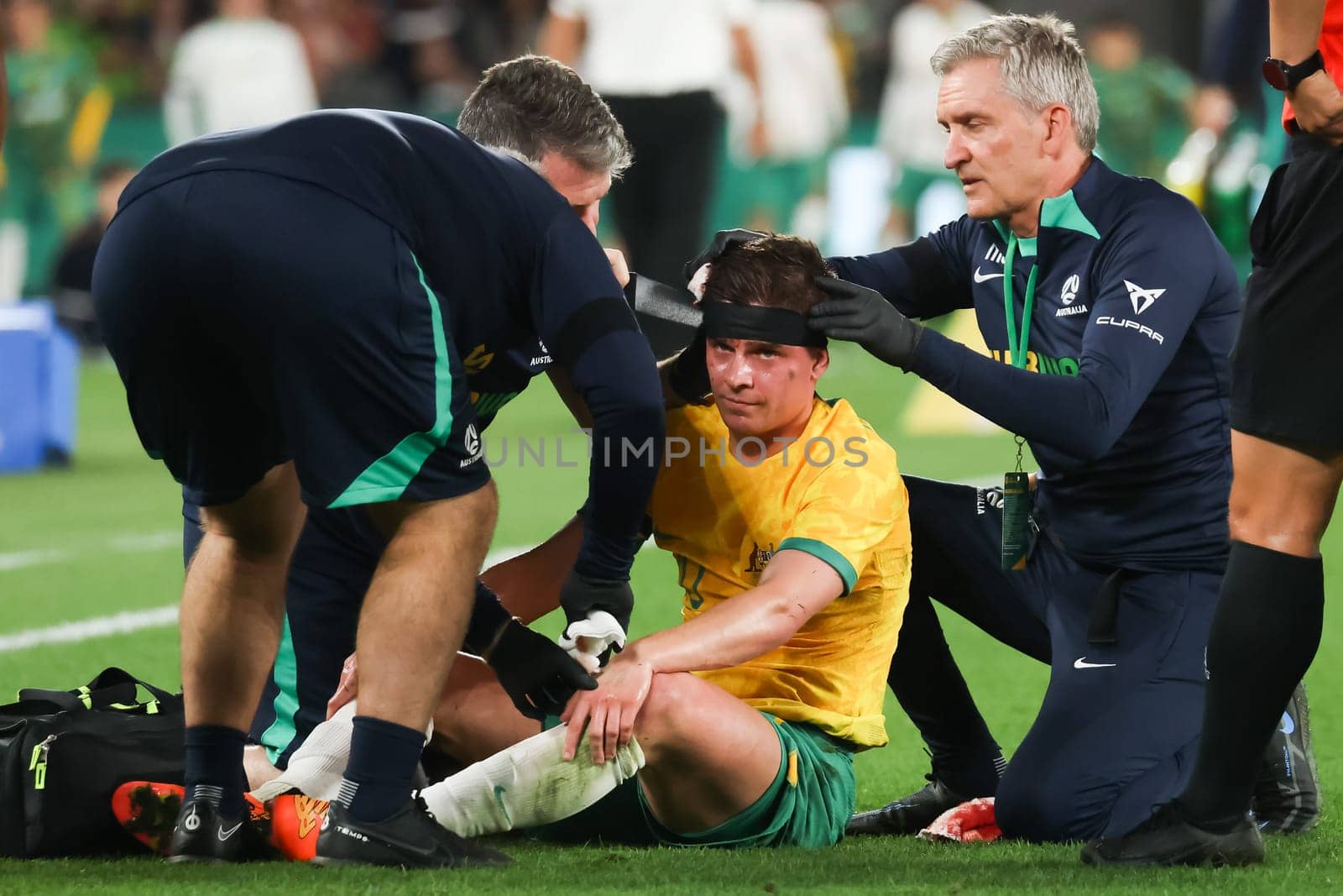 MELBOURNE, AUSTRALIA - MARCH 28: Cameron Devlin of Australia has a cut to the head during an international friendly match between the Australia Socceroos and Ecuador at Marvel Stadium on March 28, 2023 in Melbourne, Australia.