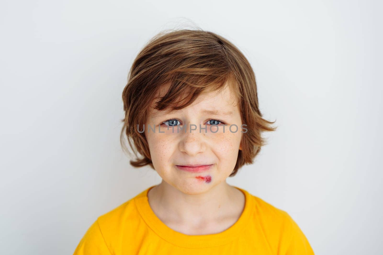 Portrait of school boy kid child crying due to sore bruised wound on his face. Caucasian schoolboy in yellow t-shirt crying of pain as he hurt his face on white background with copy space for text.