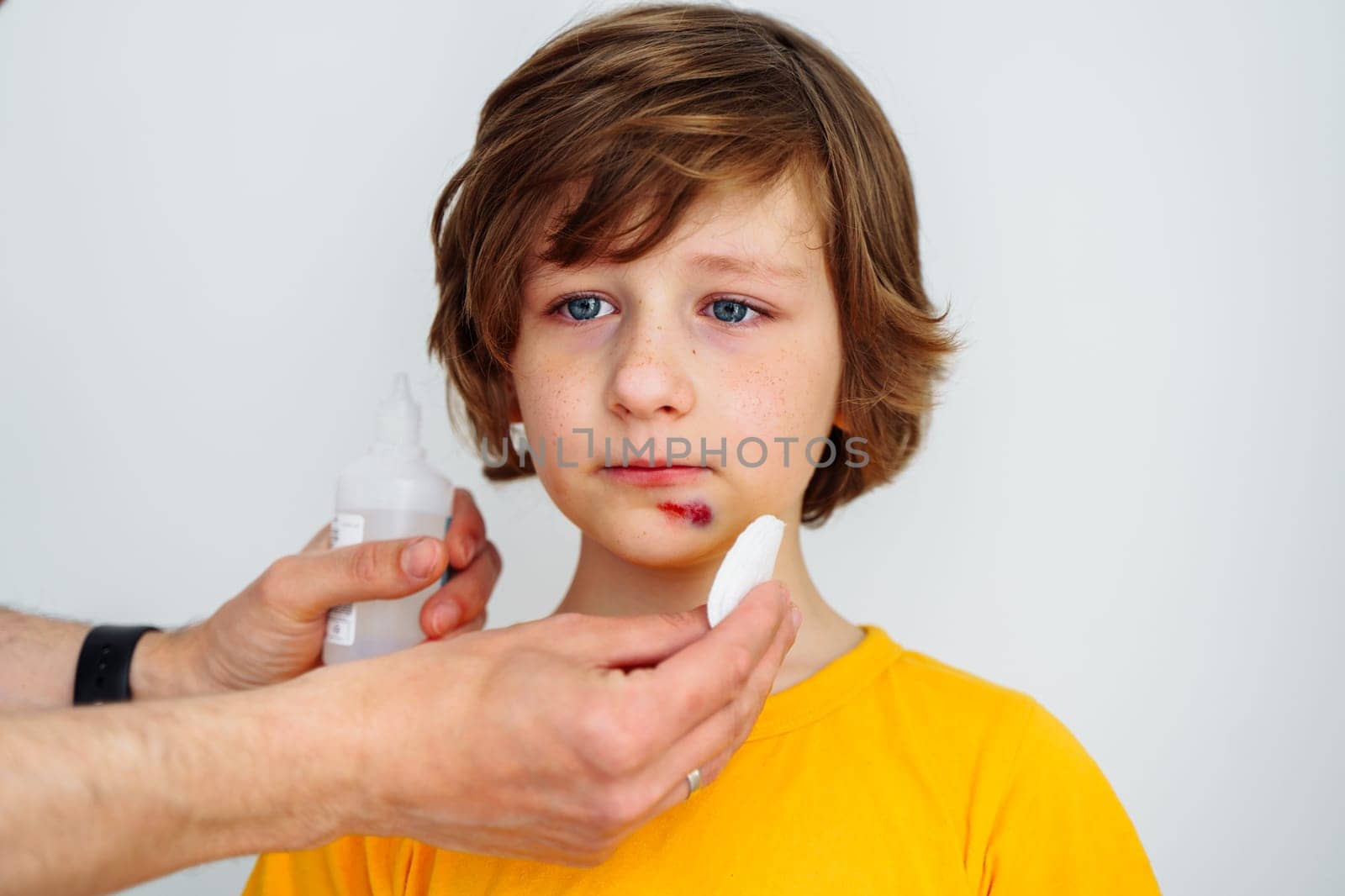Dad doctor father treats bruised wound on his son school boy kid face. Man cleans addresses the sore wound on child face on white background with copy space for text.