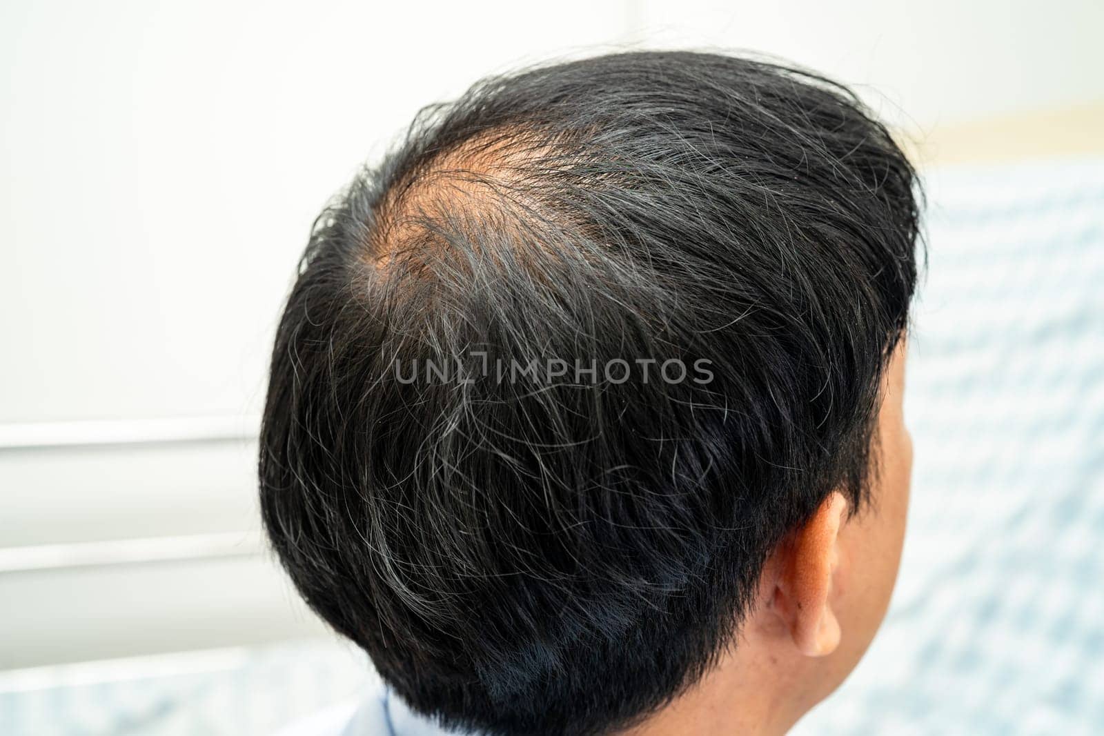 Bald at front of head and begin no loss hair glabrous of mature Asian business smart active office man. by pamai