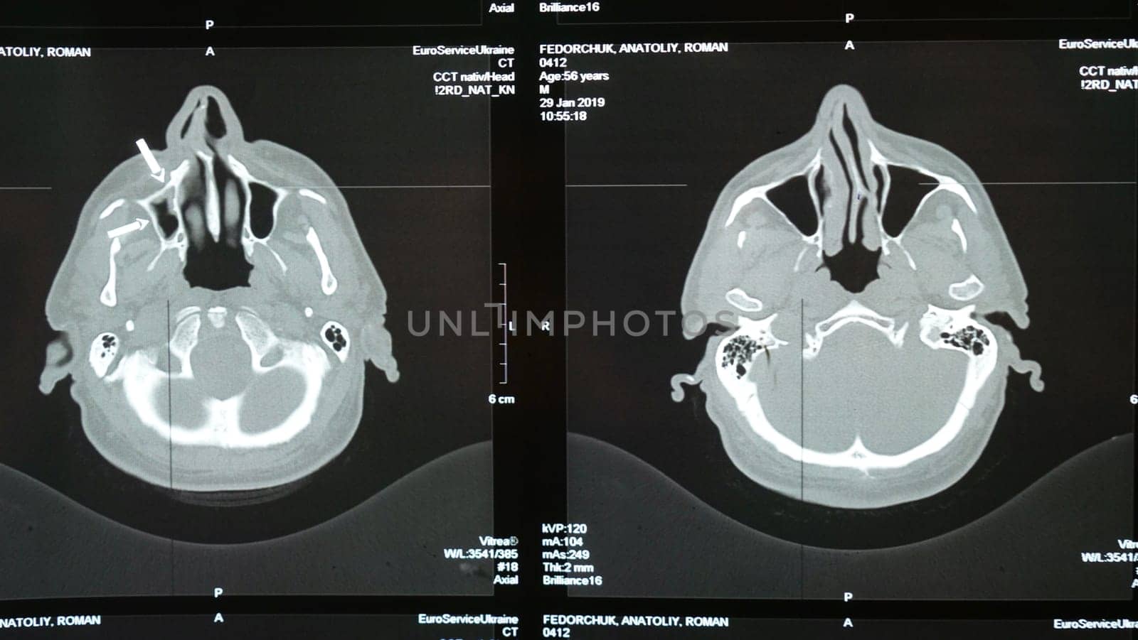 MRI of the brain of an older man by OksanaFedorchuk