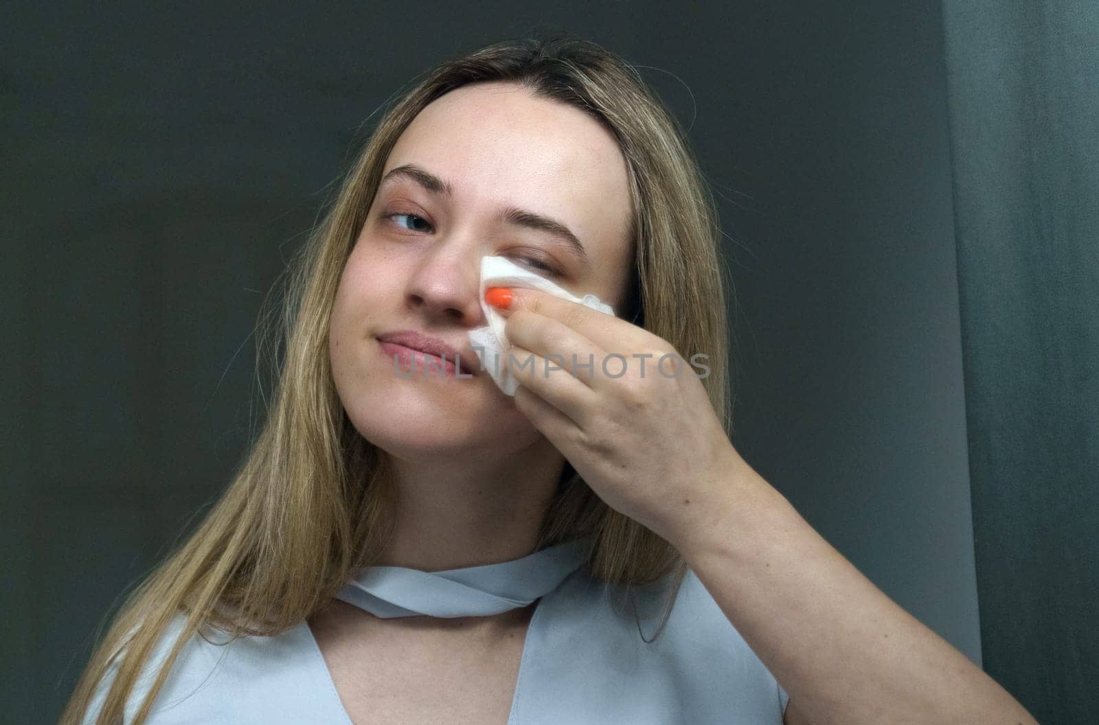 Young woman cleans her face with napkins. Close-up