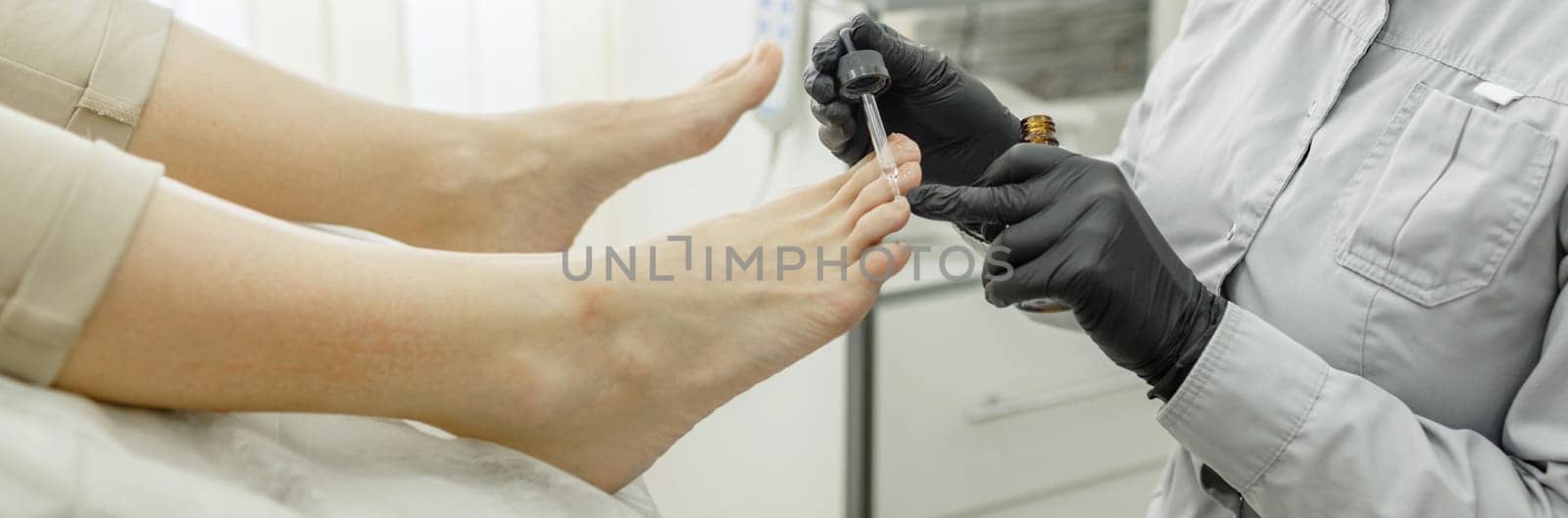 Therapeutic pedicure. The pedicure master applies a softening oil or a medicinal product in a pipette to the nails