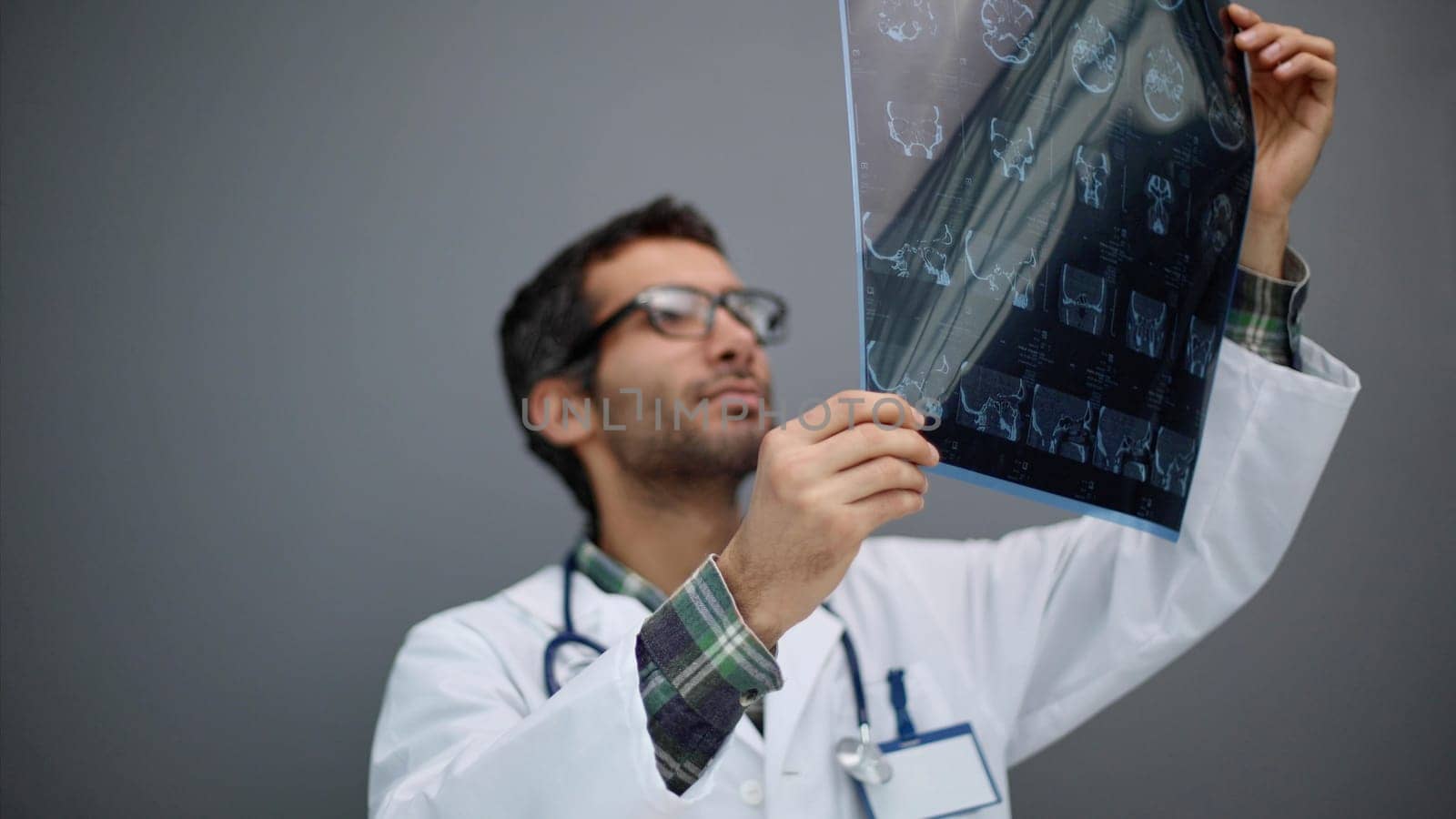 film diagnosing elderly ageing patient neurodegenerative illness problem for neurological medical treatment
