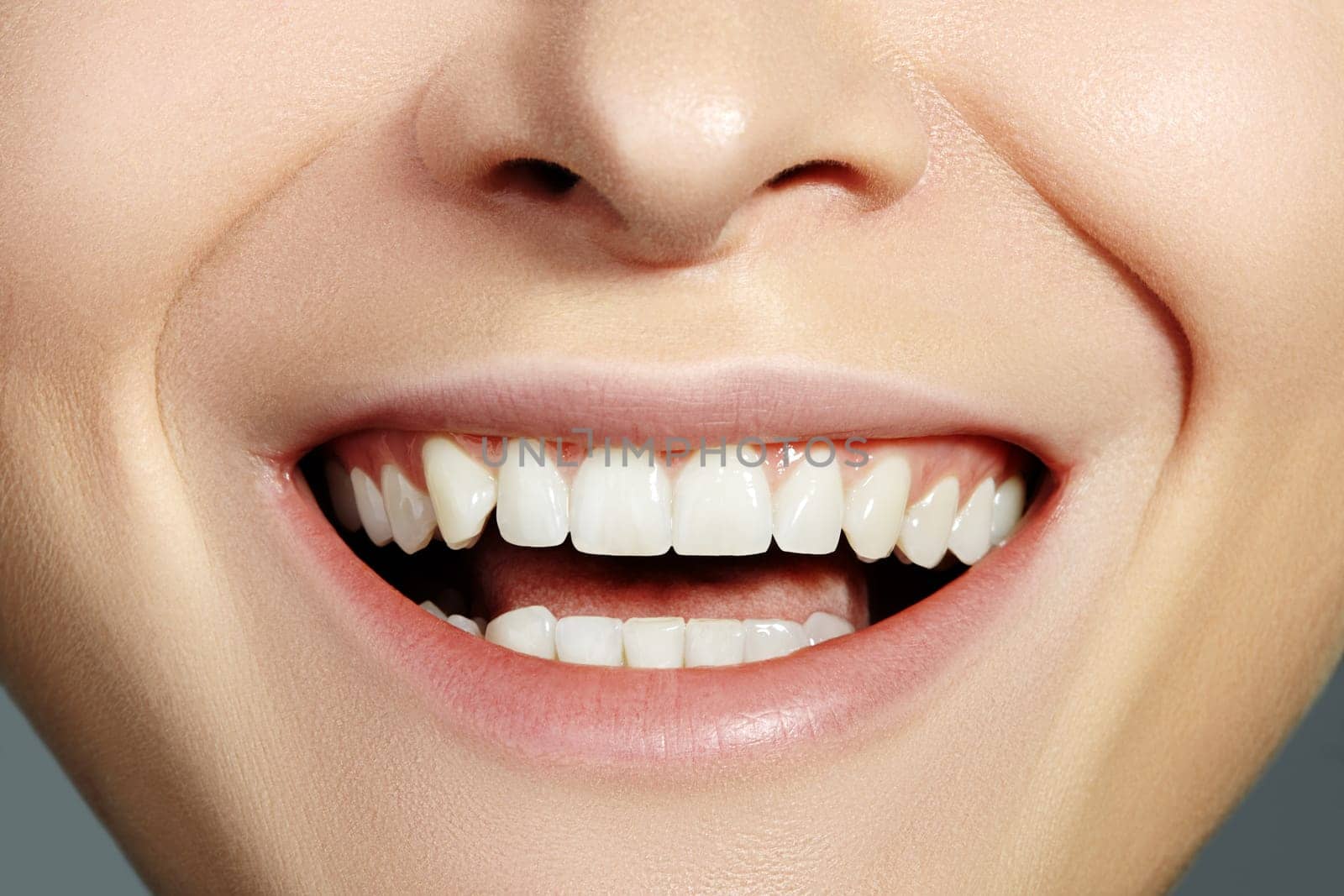 Dental Beauty. Beautiful Macro with perfect White Teeth. Whitening Tooth, Wellness Treatment by MarinaFrost