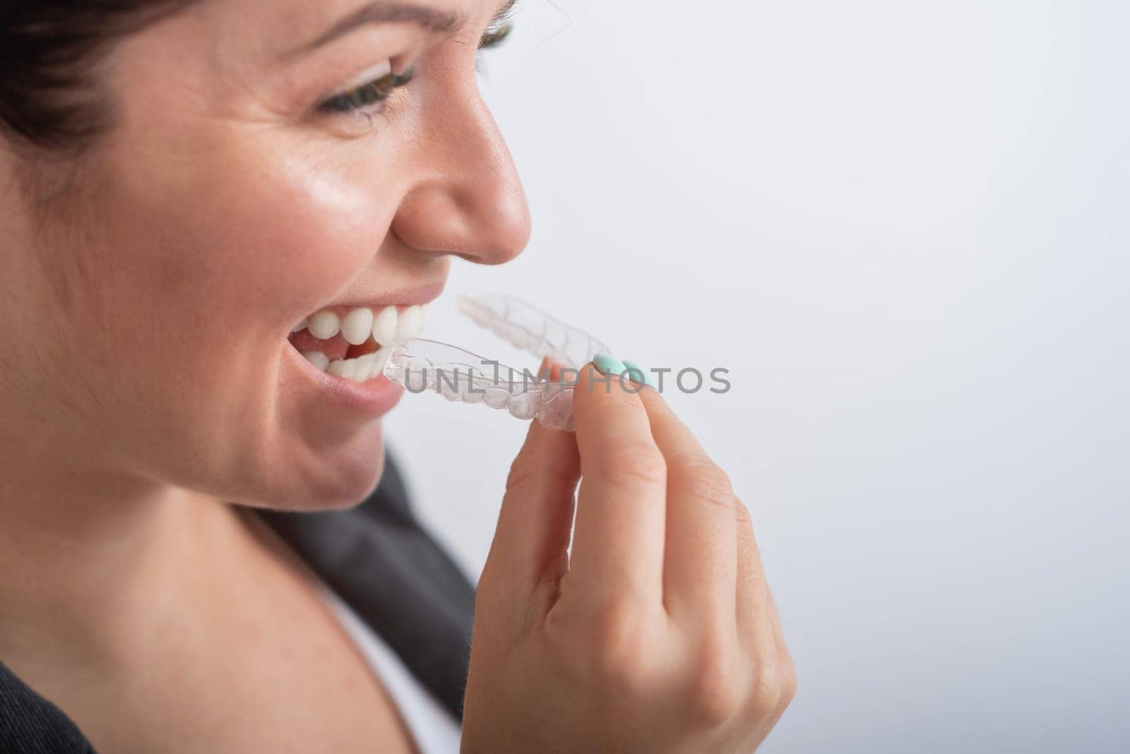 Close-up of a woman putting on transparent plastic retainers. The girl uses a device to straighten her teeth by mrwed54