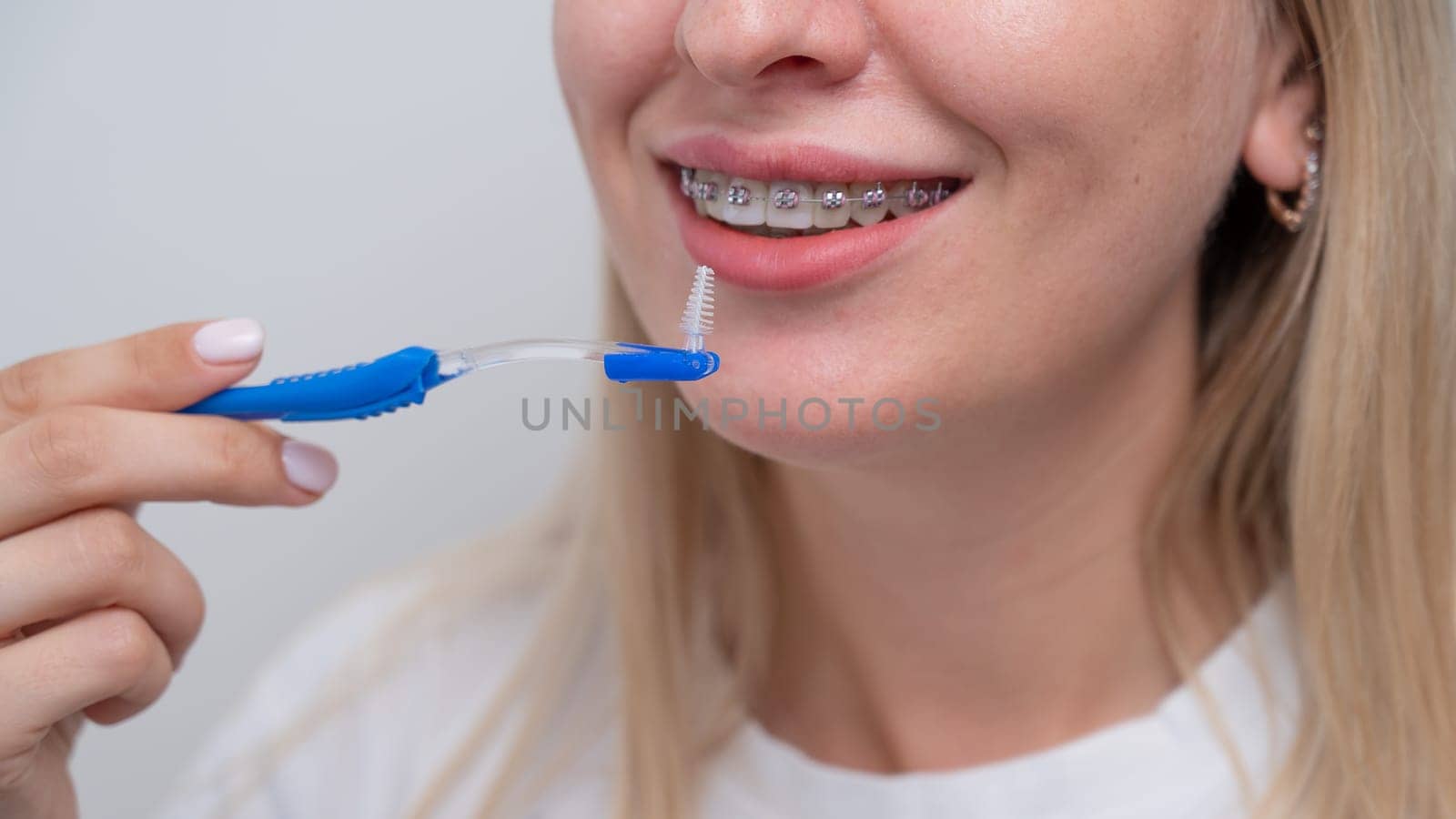 Caucasian woman cleaning her teeth with braces using a brush. Cropped portrait. by mrwed54