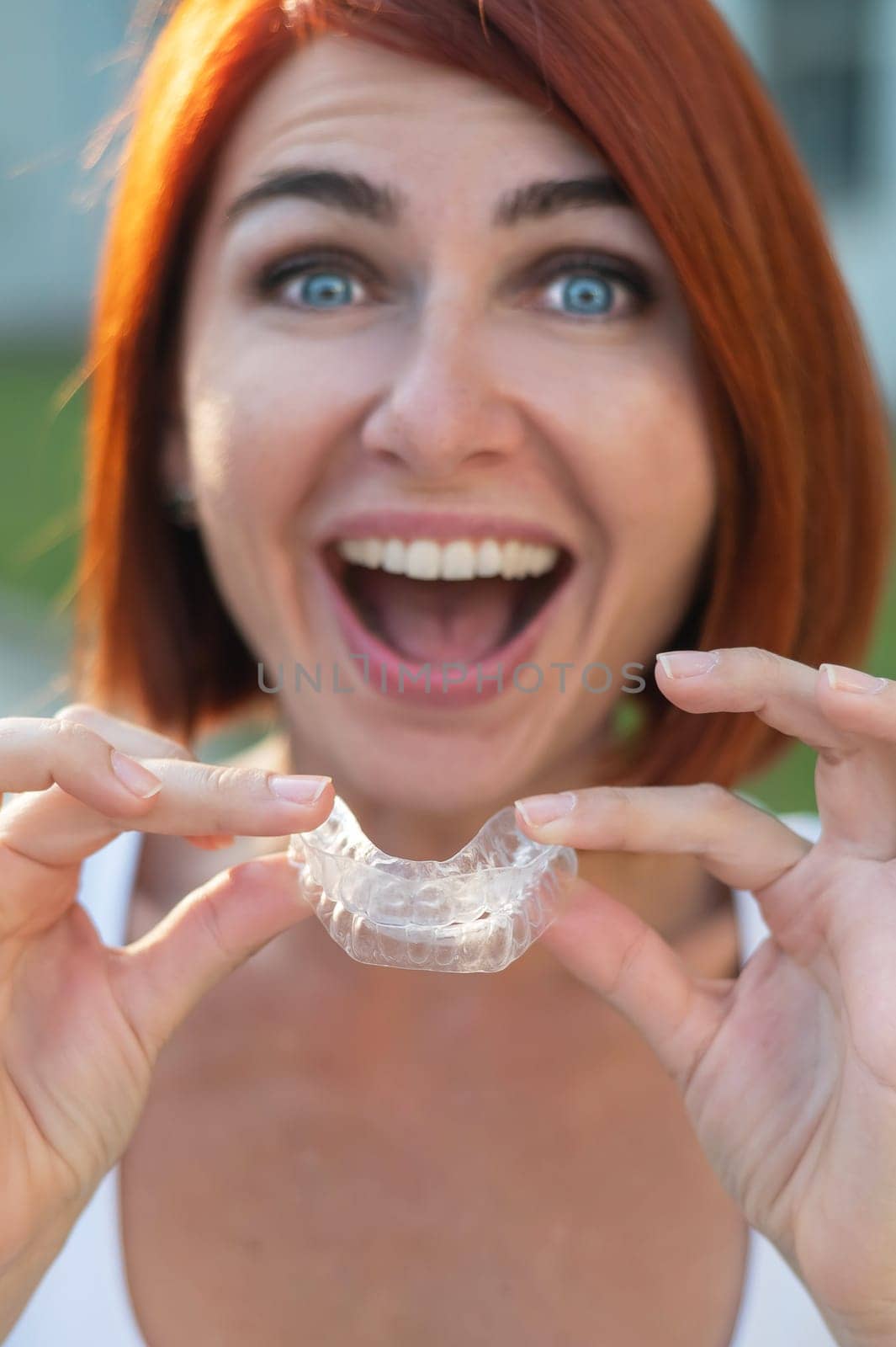 Red-haired Caucasian woman holding transparent mouthguards for bite correction outdoors. A girl with a beautiful snow-white smile uses silicone braces.