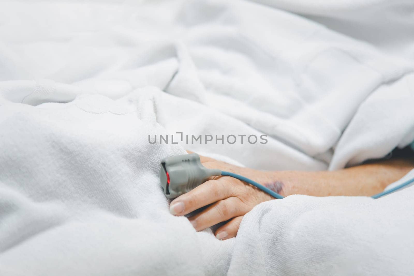Patient in the hospital with pulse gauge on finger by PongMoji