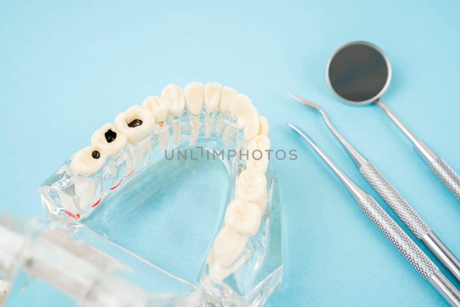 Healthy and decayed teeth model and mouth mirror, Dental concepts.