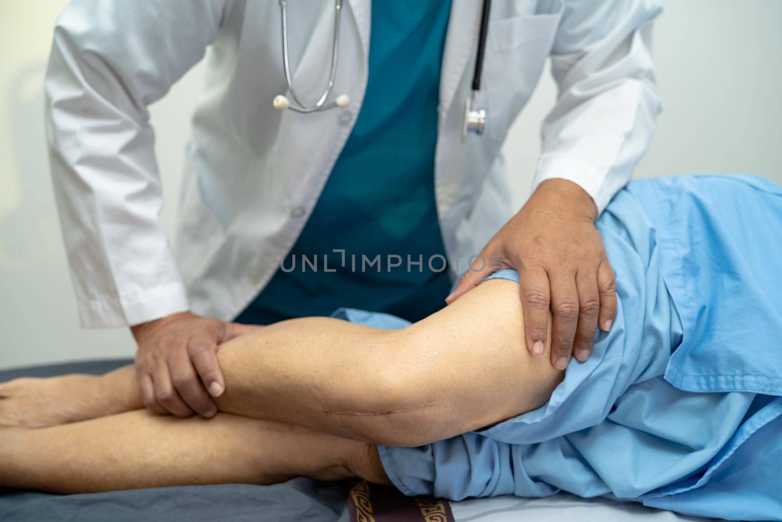 Asian elderly woman patient show her scars surgical total knee joint replacement Suture wound surgery arthroplasty on bed in nursing hospital ward, healthy strong medical concept. by pamai