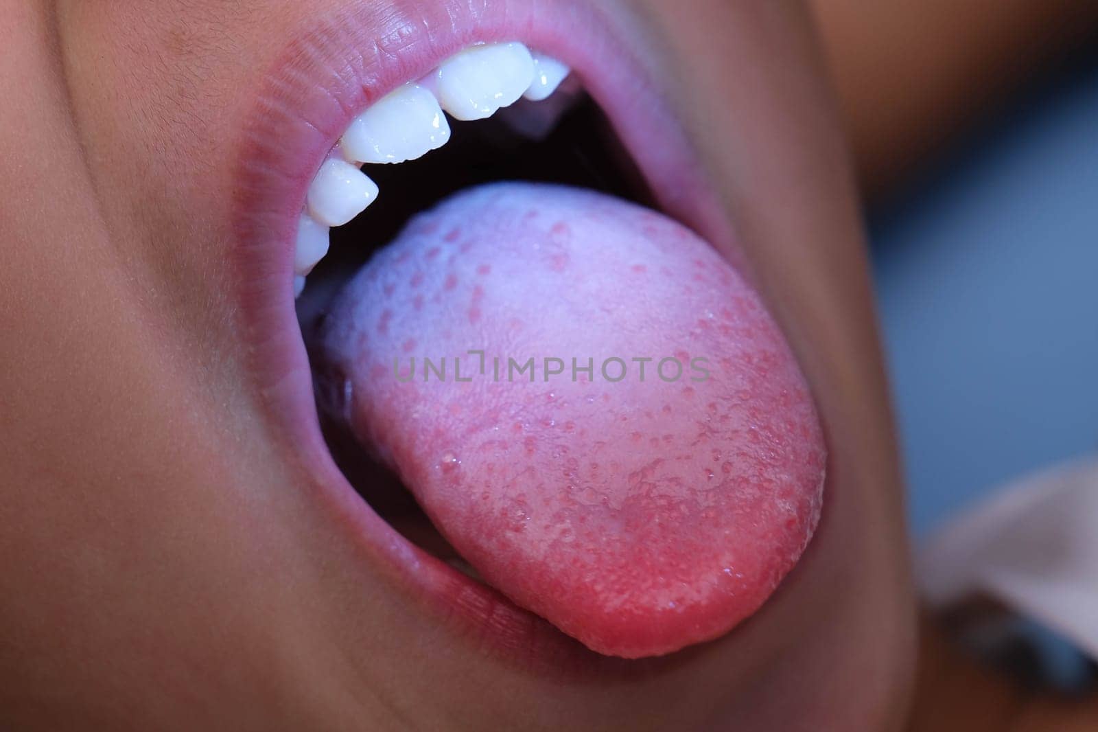 Close-up inside the oral cavity of a healthy child with beautiful rows of baby teeth. Young girl opens mouth revealing upper and lower teeth, hard palate, soft palate, dental and oral health checkup.