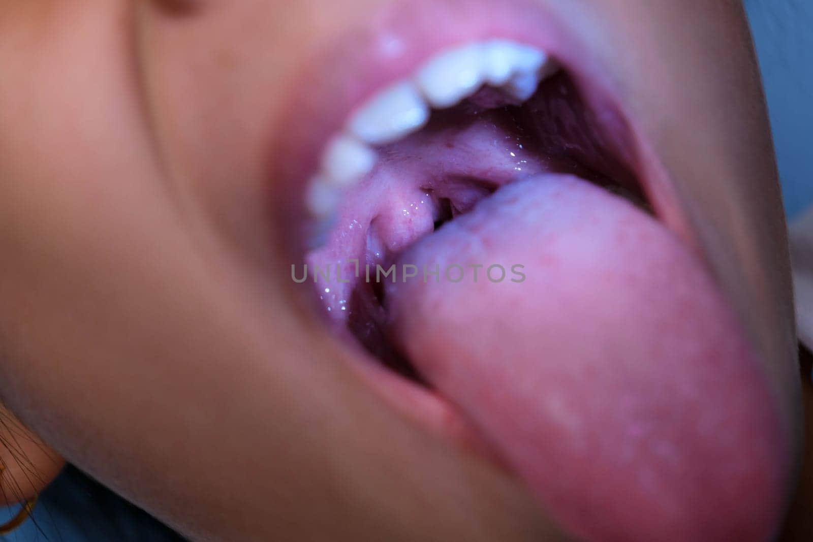 Close-up inside the oral cavity of a healthy child with beautiful rows of baby teeth. Young girl opens mouth revealing upper and lower teeth, hard palate, soft palate, dental and oral health checkup. by TEERASAK