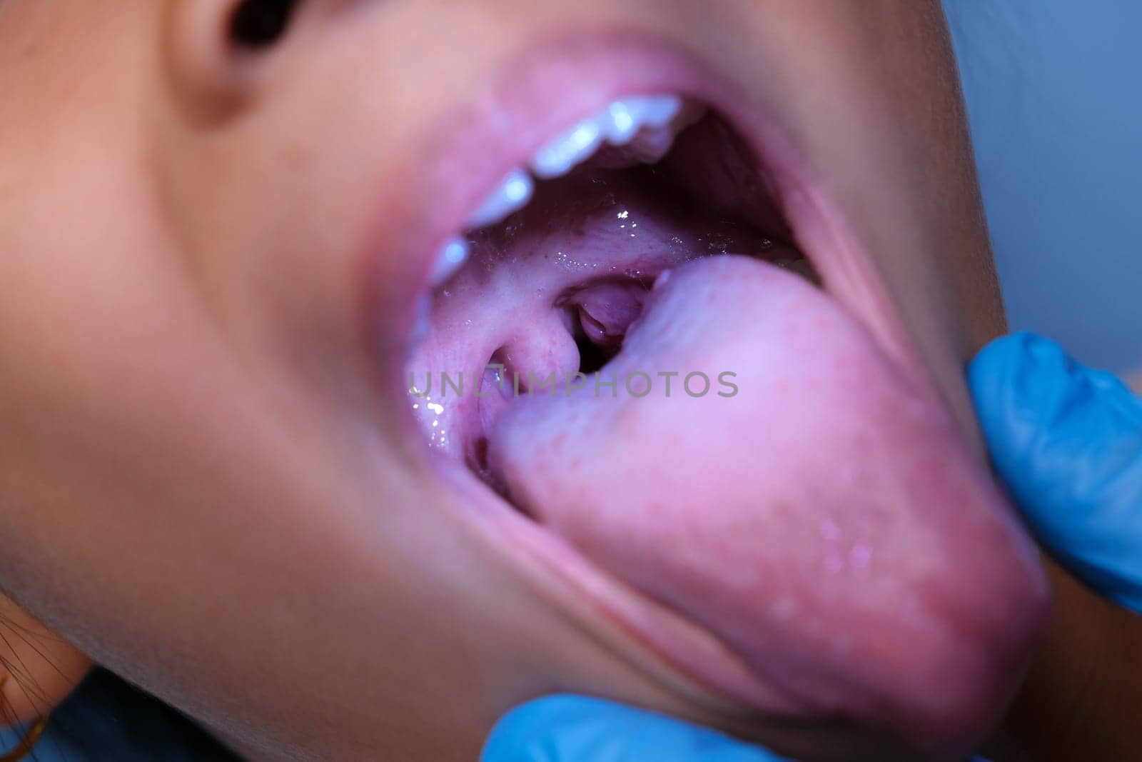 Close-up inside the oral cavity of a healthy child with beautiful rows of baby teeth. Young girl opens mouth revealing upper and lower teeth, hard palate, soft palate, dental and oral health checkup.