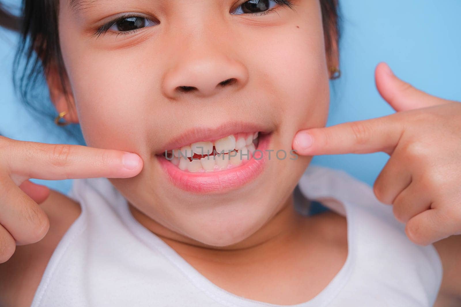 Close-up of young girl touching the corners of her mouth with index finger while smiling broadly revealing her beautiful white teeth on blue background. Concept of good health in childhood. by TEERASAK