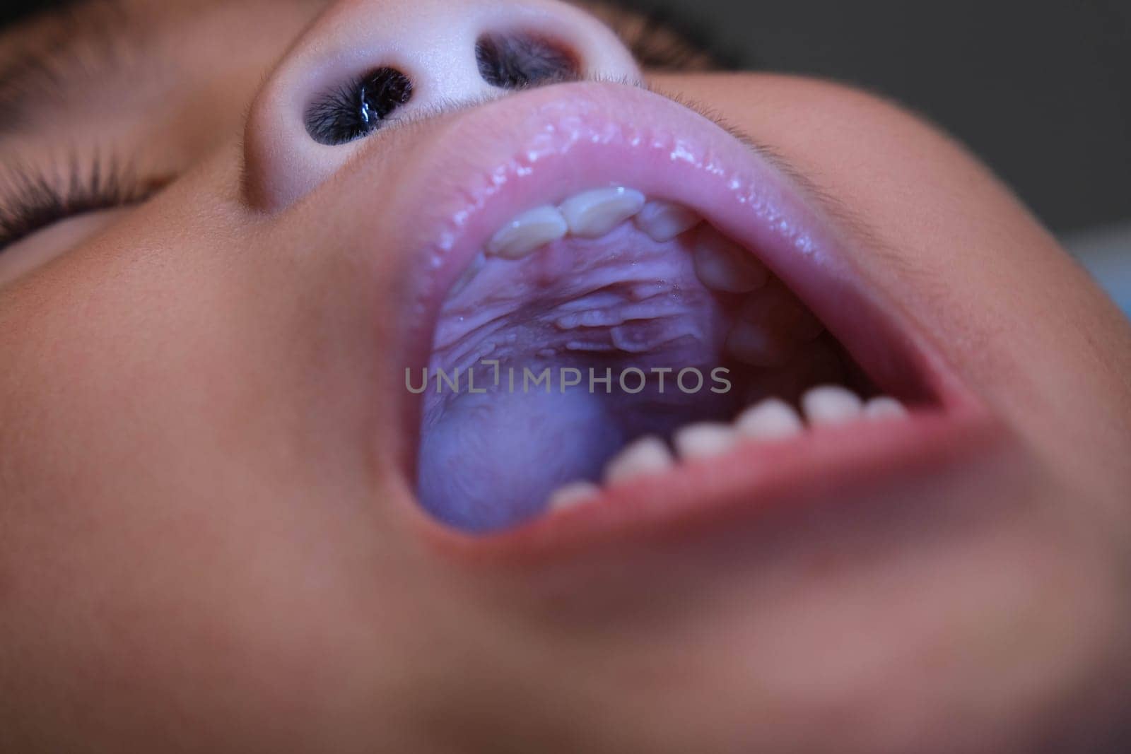 Close-up inside the oral cavity of a healthy child with beautiful rows of baby teeth. Young girl opens mouth revealing upper and lower teeth, hard palate, soft palate, dental and oral health checkup.