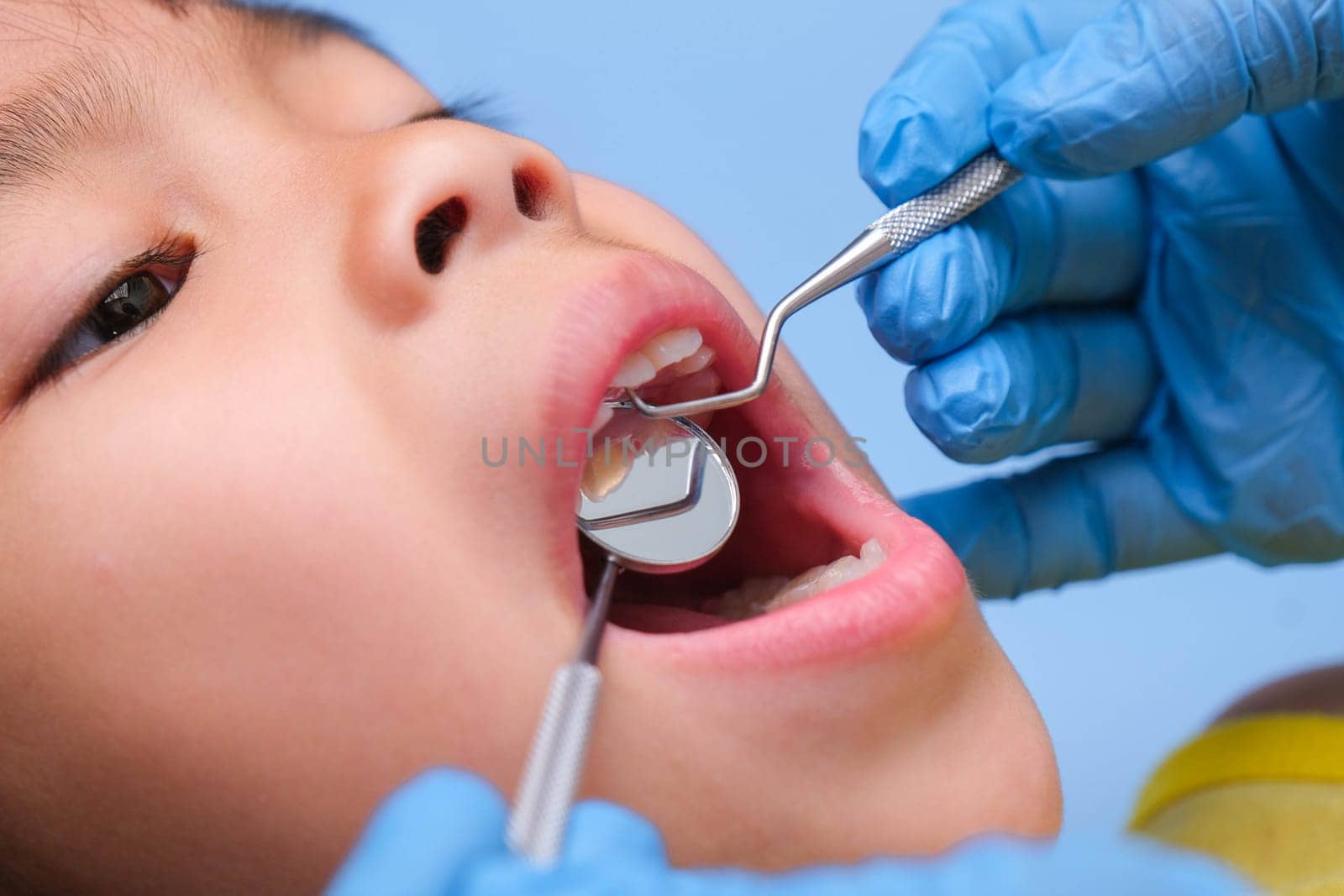 Close-up in the oral cavity of a healthy child with beautiful white teeth. Young girl opens her mouth to reveal healthy teeth, hard and soft palate. Dental and oral health check by TEERASAK