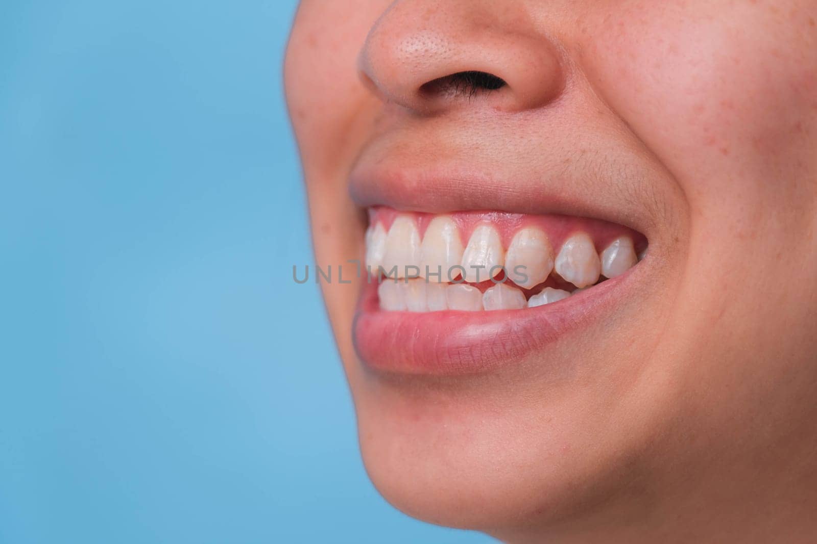 Close-up of front view of happy asian woman smiling broadly revealing her beautiful white teeth isolated on pink background. by TEERASAK