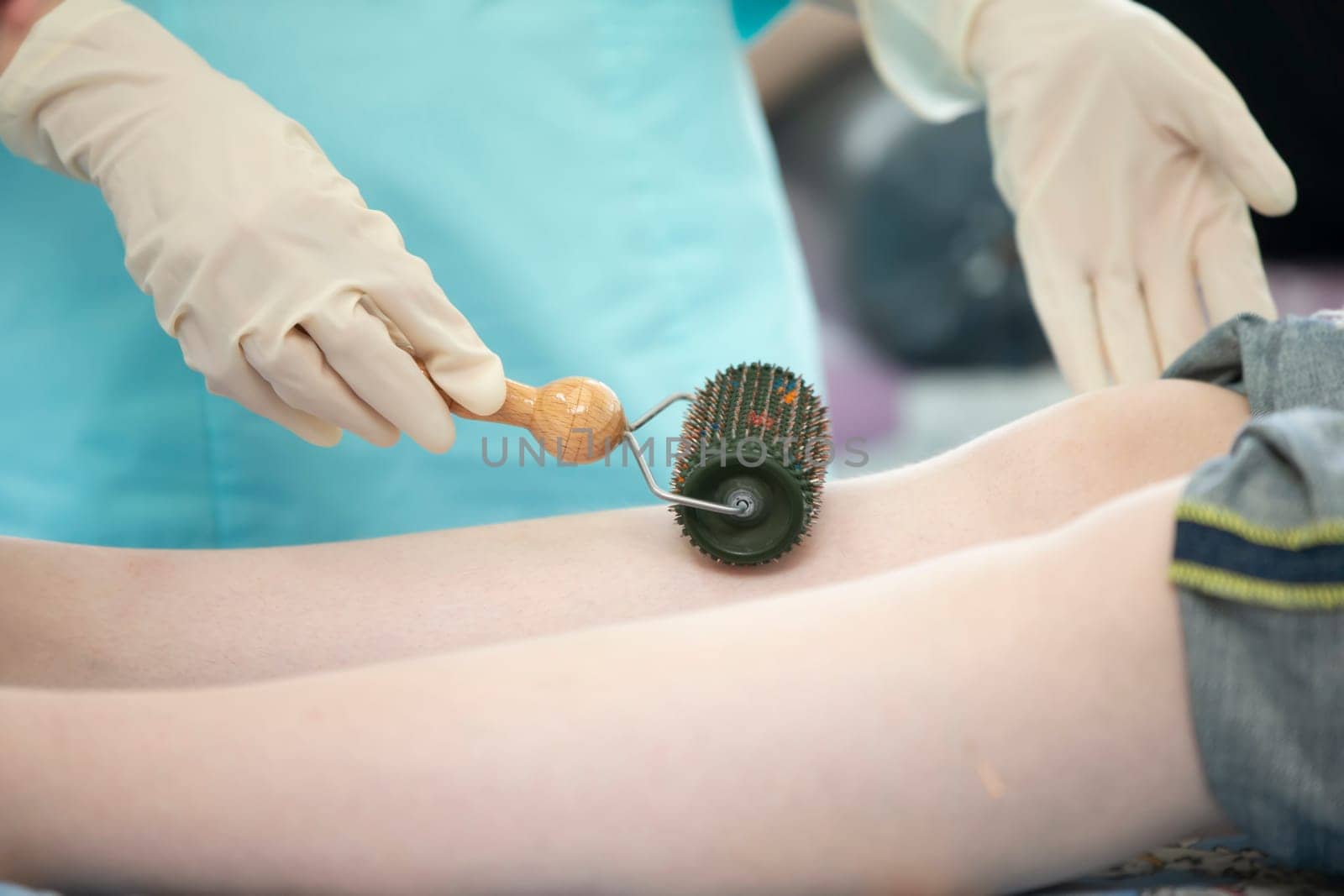 The doctor makes the patient acupuncture and vacuum massage.