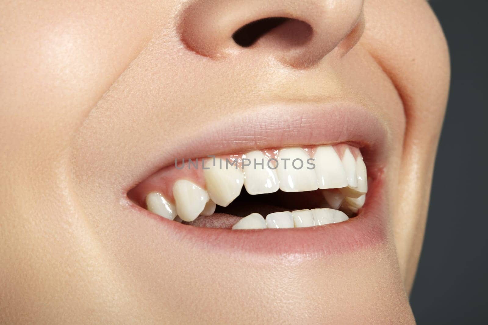 Cropped half face portrait of woman. Closeup Dental Beauty. Beautiful Macro with perfect White Teeth. Sexy Fashion Lips Red Make-up. Whitening Tooth and Wellness Treatment