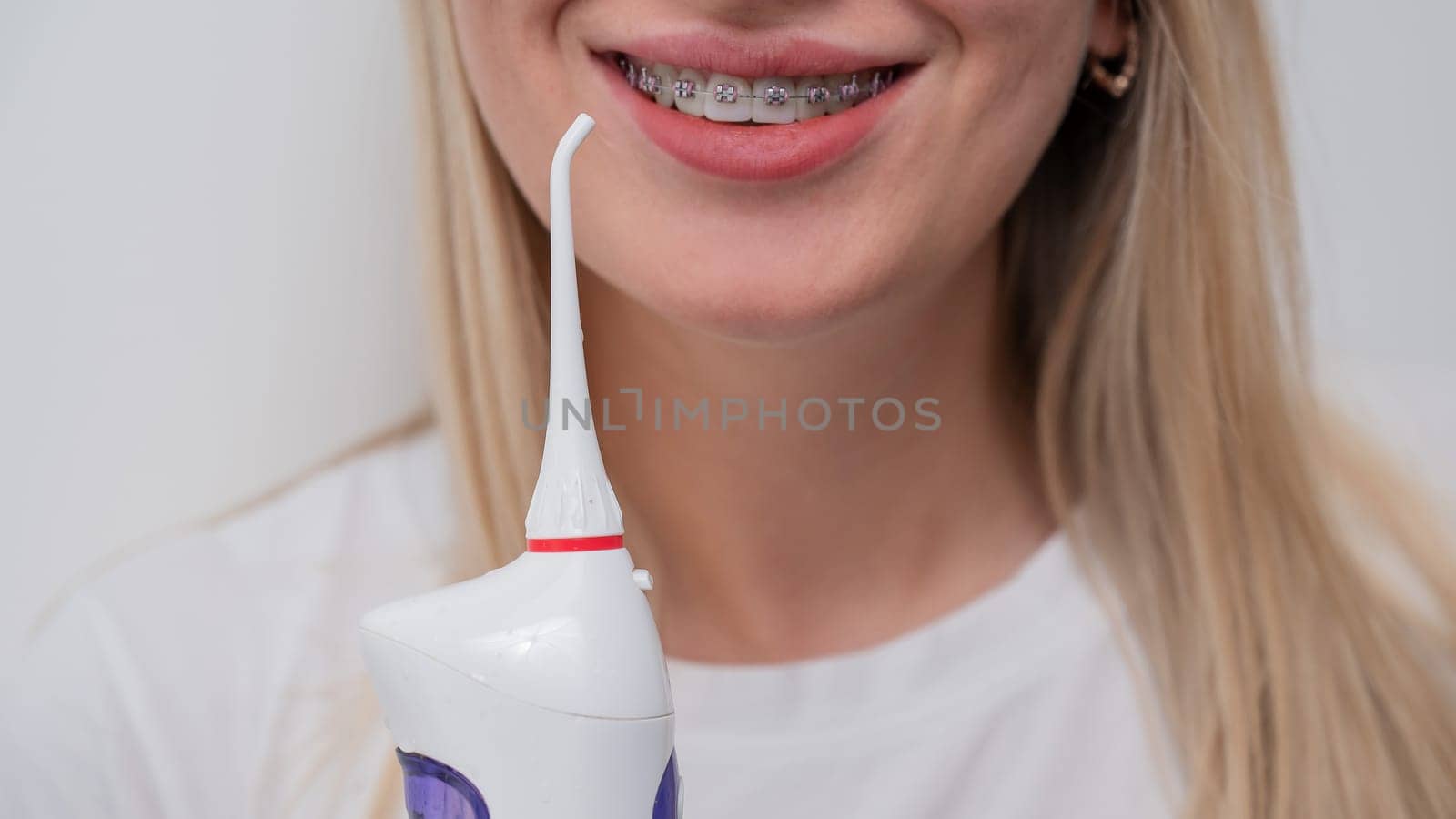 Cropped portrait of a caucasian woman with braces on her teeth holding an irrigator