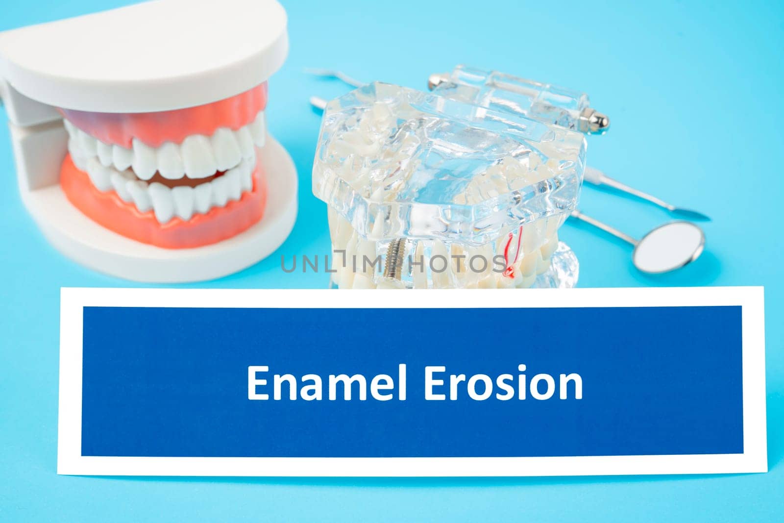 Teeth model and Enamel Erosion dental disease with tools dental on blue background.