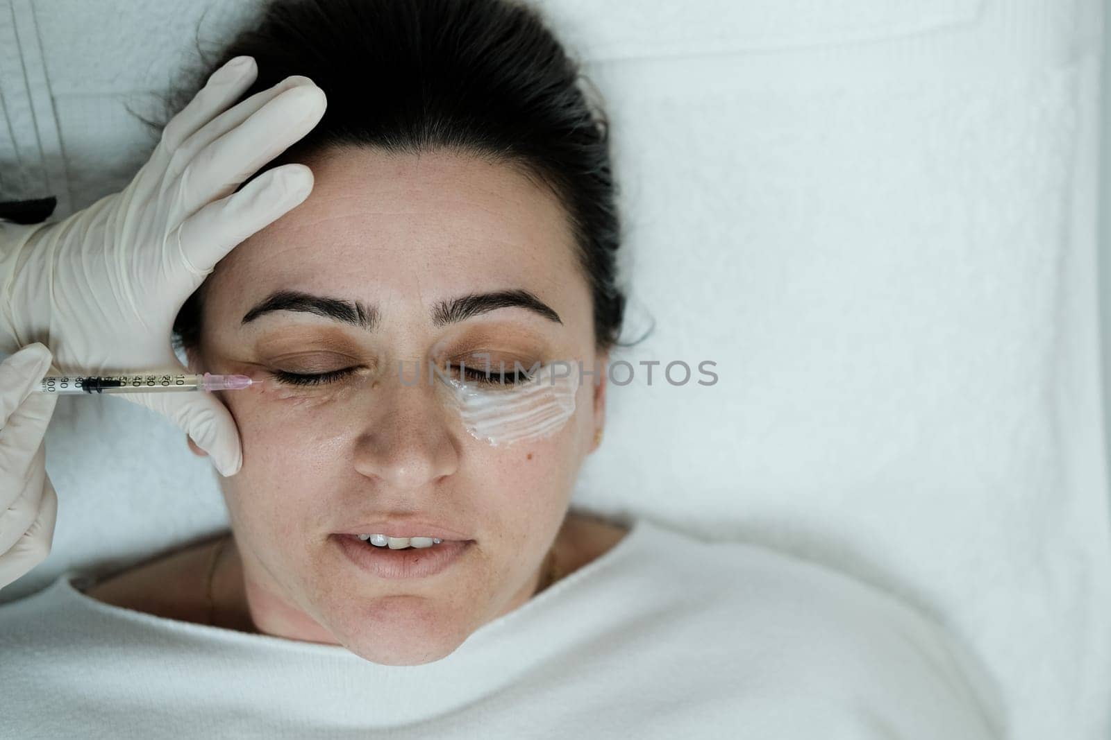 Top view of female patient having eye mesotheraphy applied by danjelaruci