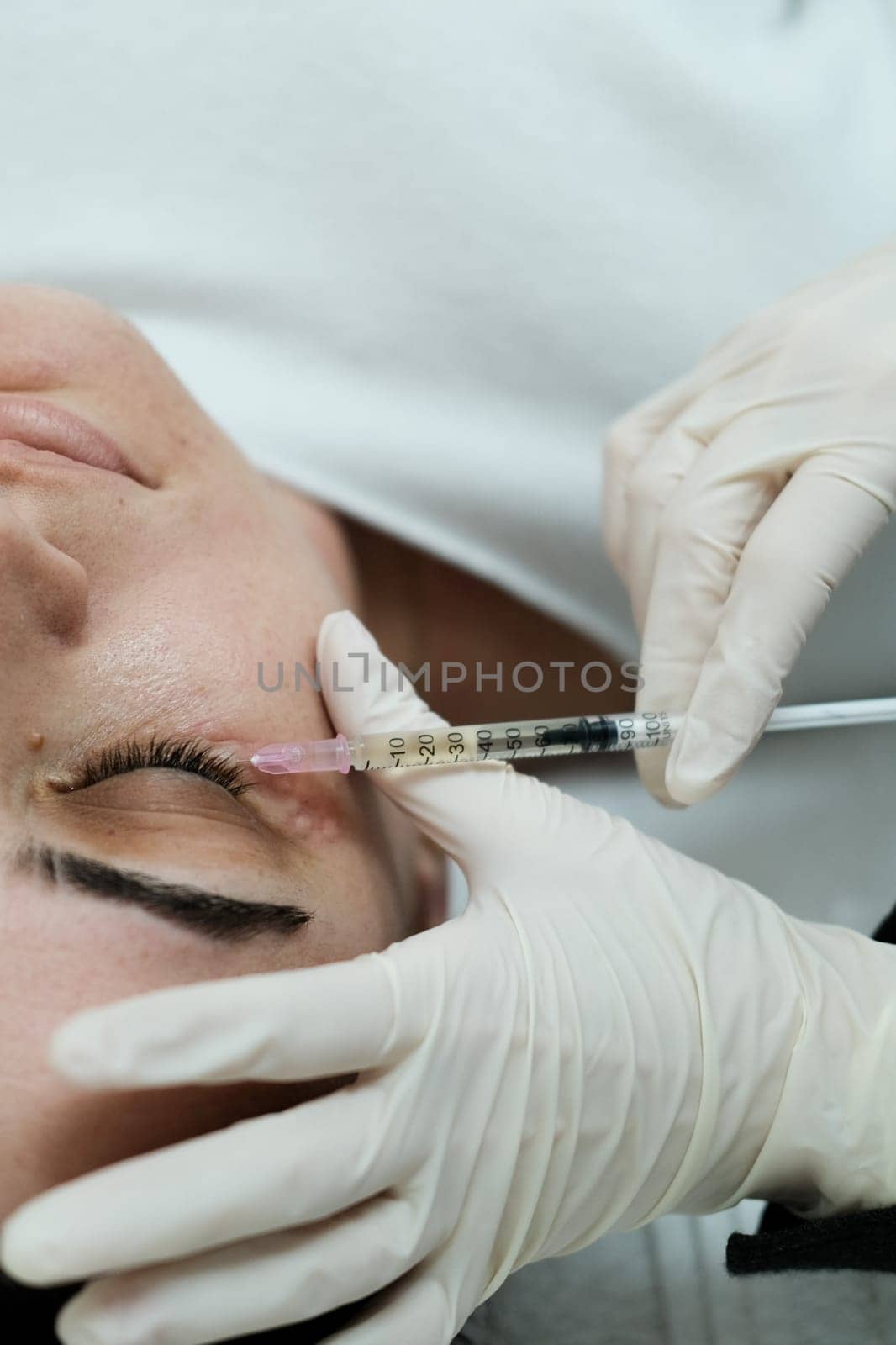 Closeup view of eye mesotherapy procedure being applied on female patient's face. Cosmetologist applying eye mesotherapy to female patient. Serum being applied in the undereye area via a syringe.